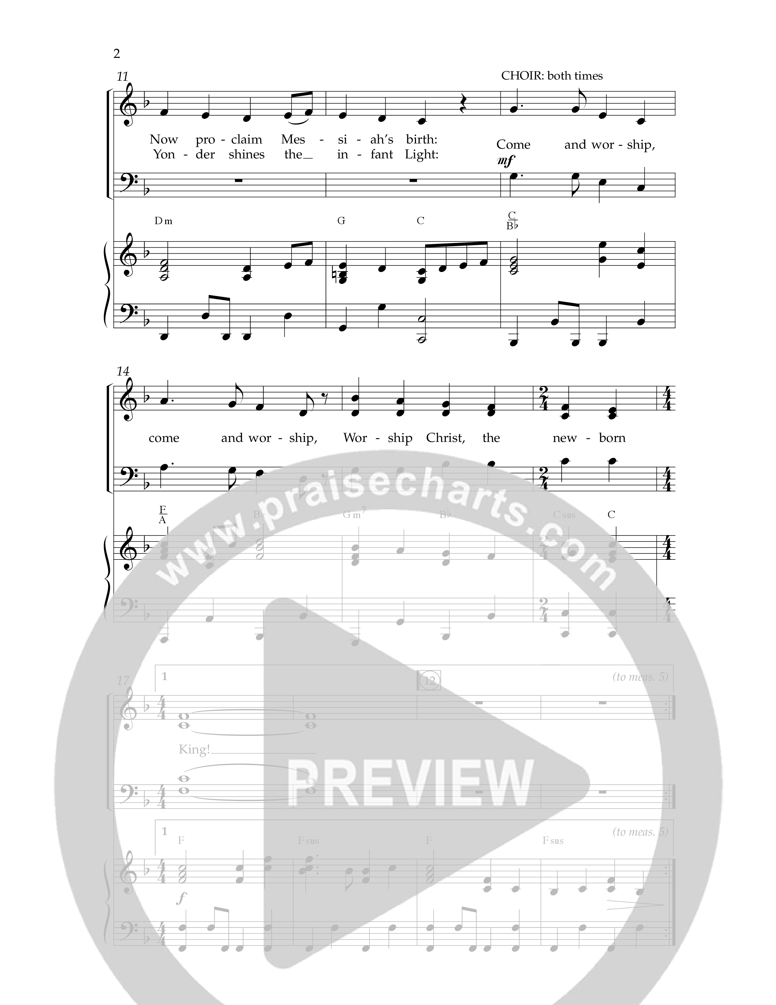 Angels From The Realms Of Glory (Emmanuel) (Choral Anthem SATB) Anthem (SATB/Piano) (Lifeway Choral / Arr. Dennis Allen)