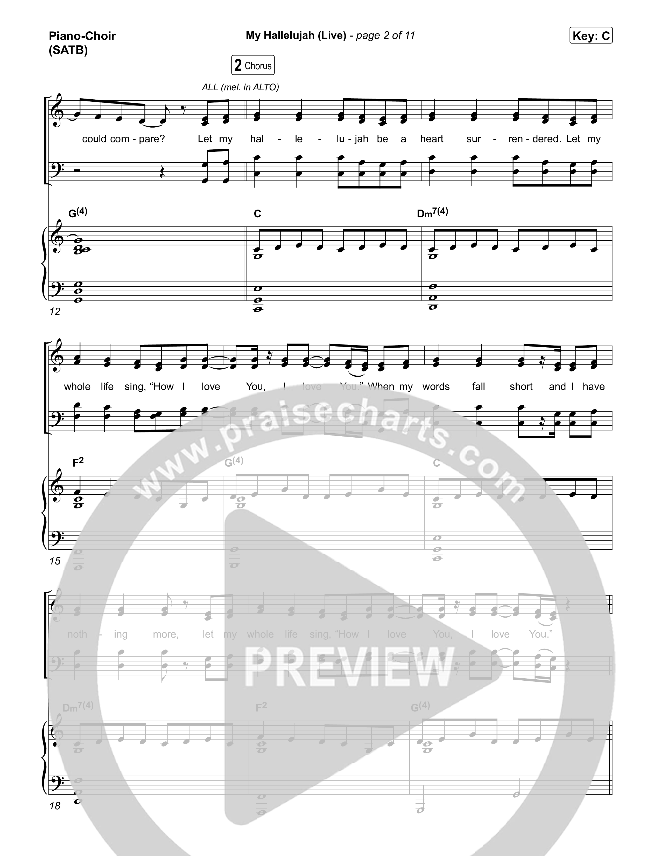 My Hallelujah (Live) Piano/Vocal Pack (Bethel Music)