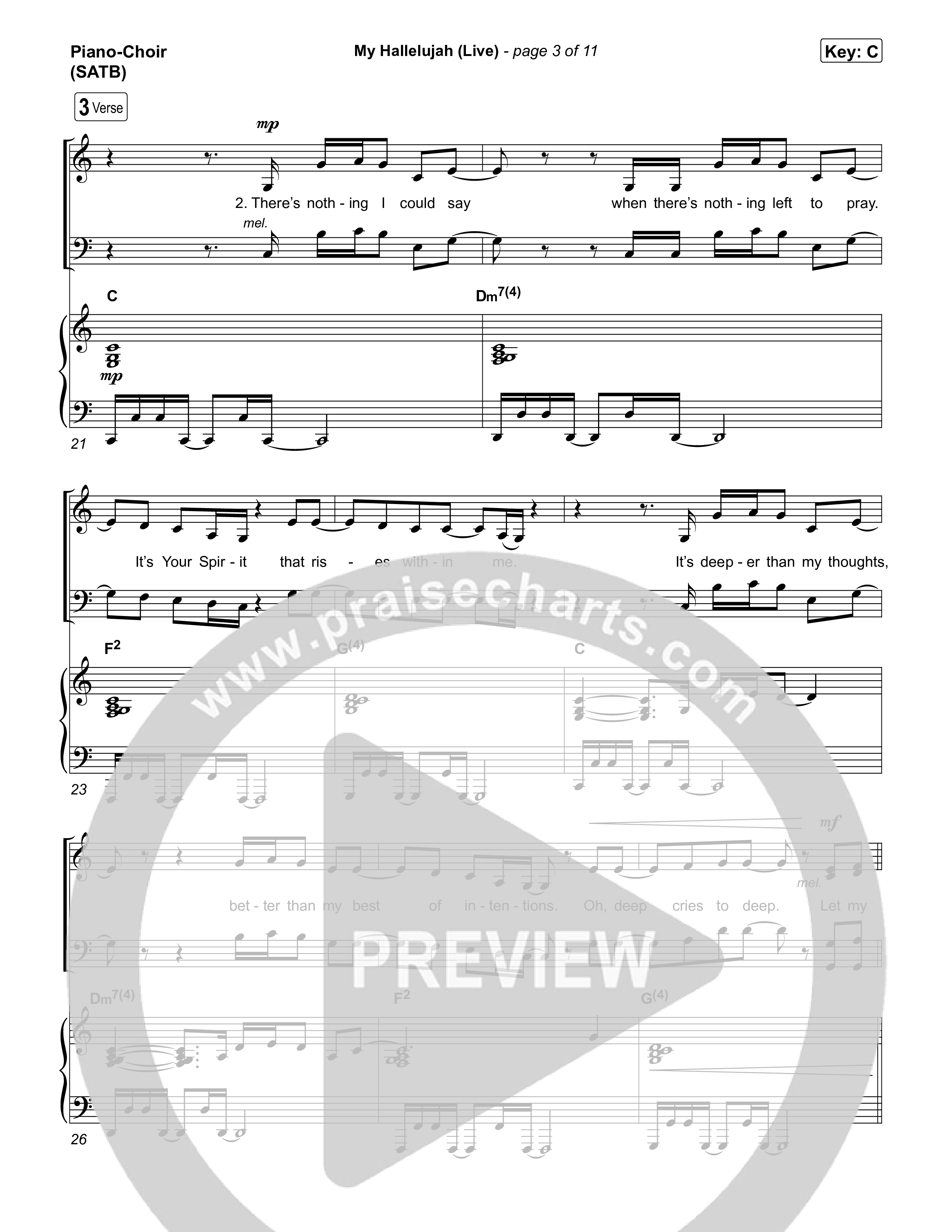 My Hallelujah (Live) Piano/Vocal Pack (Bethel Music)