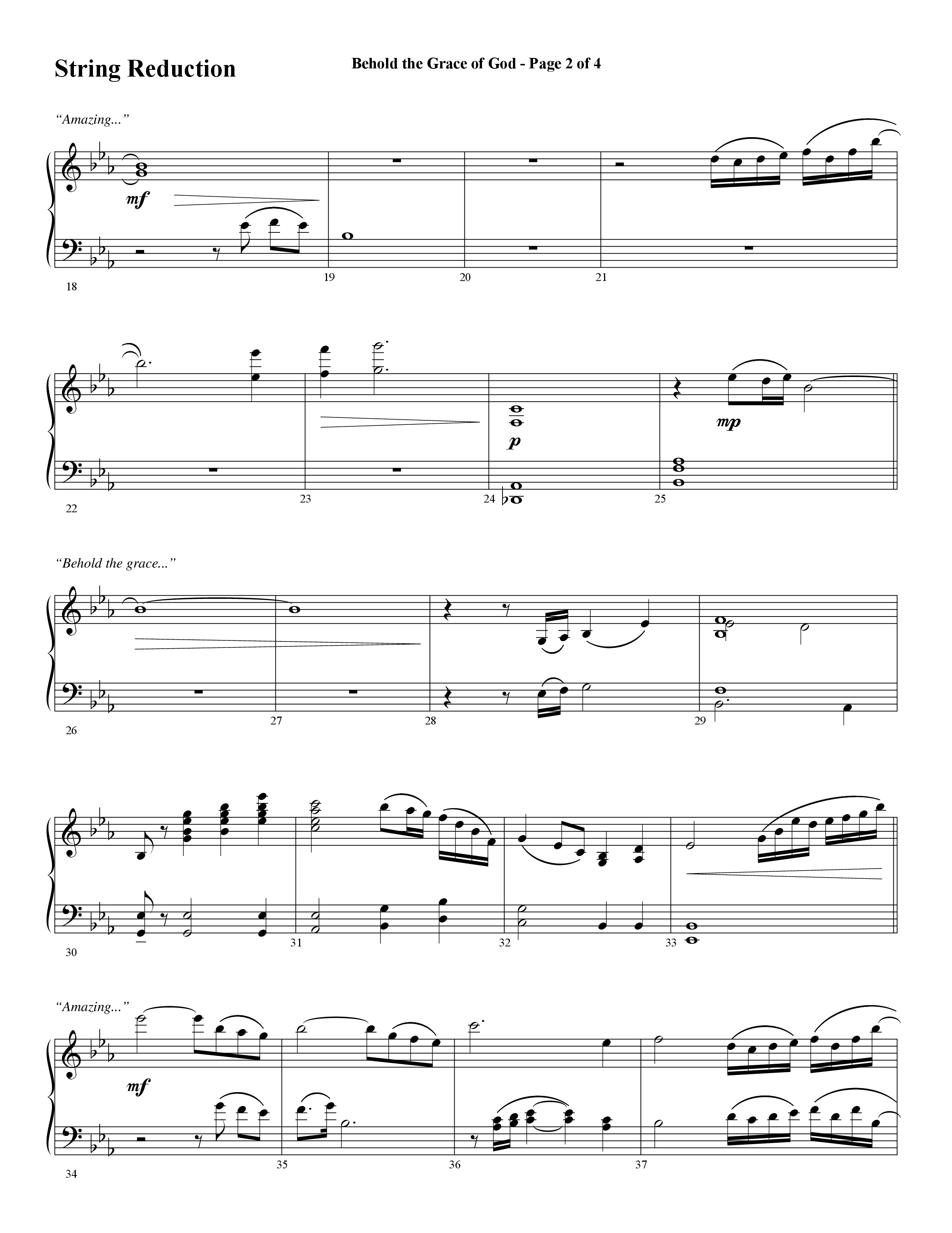 Behold The Grace Of God (Choral Anthem SATB) String Reduction (Word Music Choral / Arr. J. Daniel Smith)