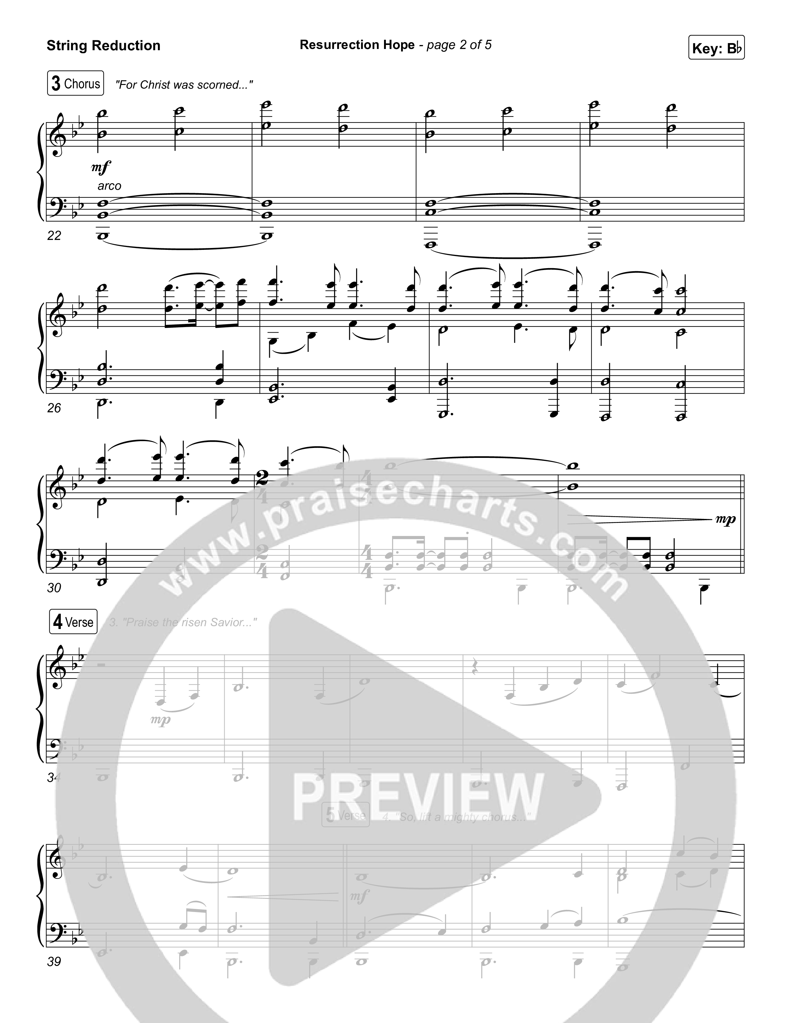 Resurrection Hope String Reduction (Aaron Williams)