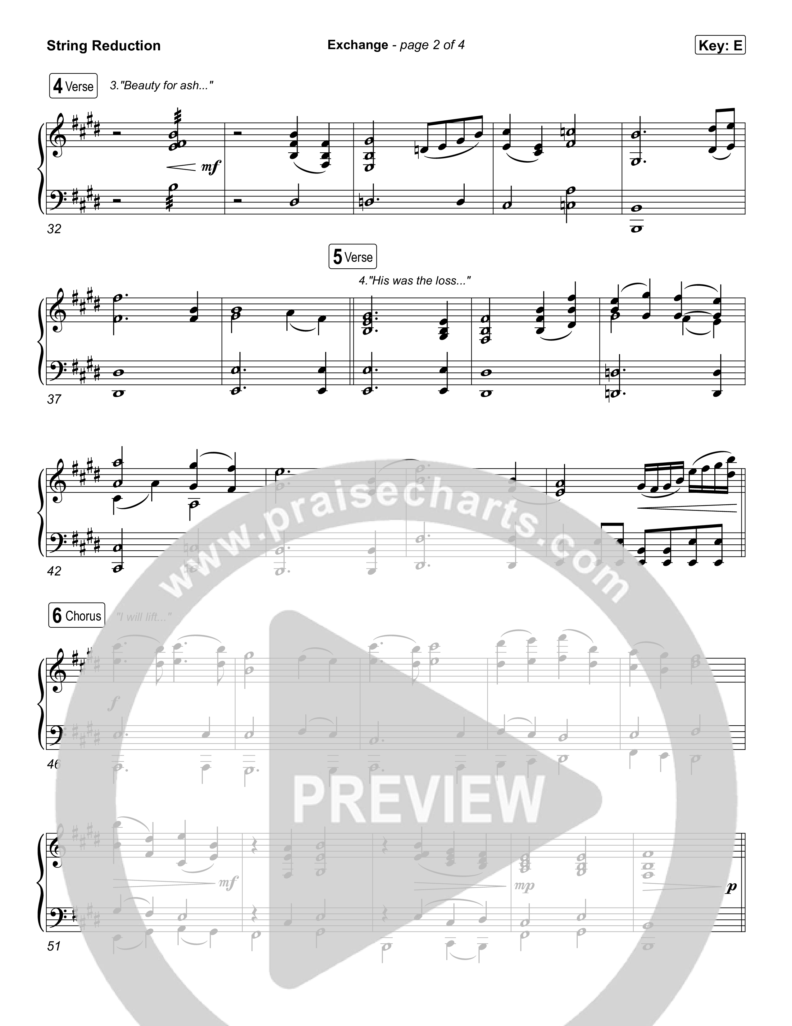 Exchange String Reduction (Sons Of Sunday)