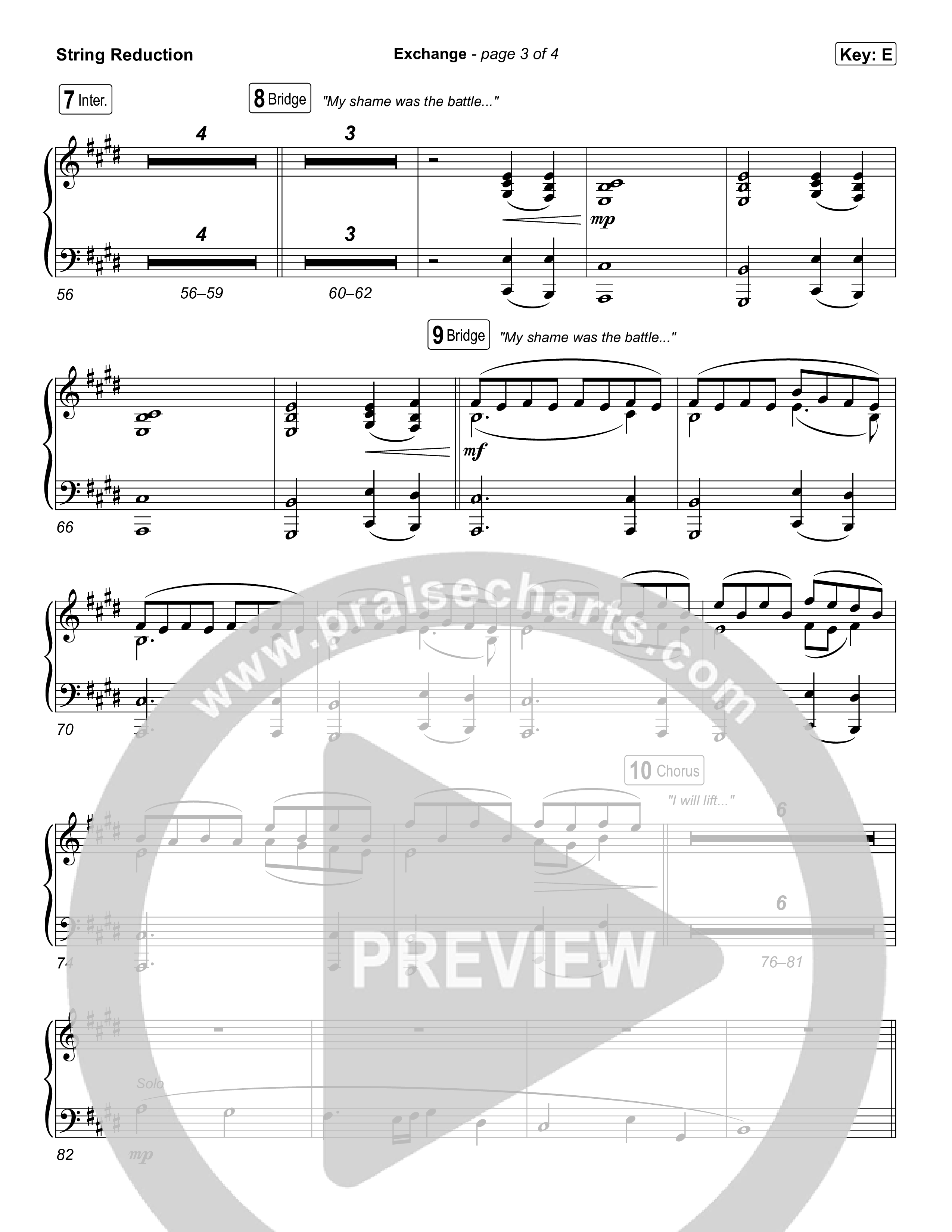 Exchange String Reduction (Sons Of Sunday)