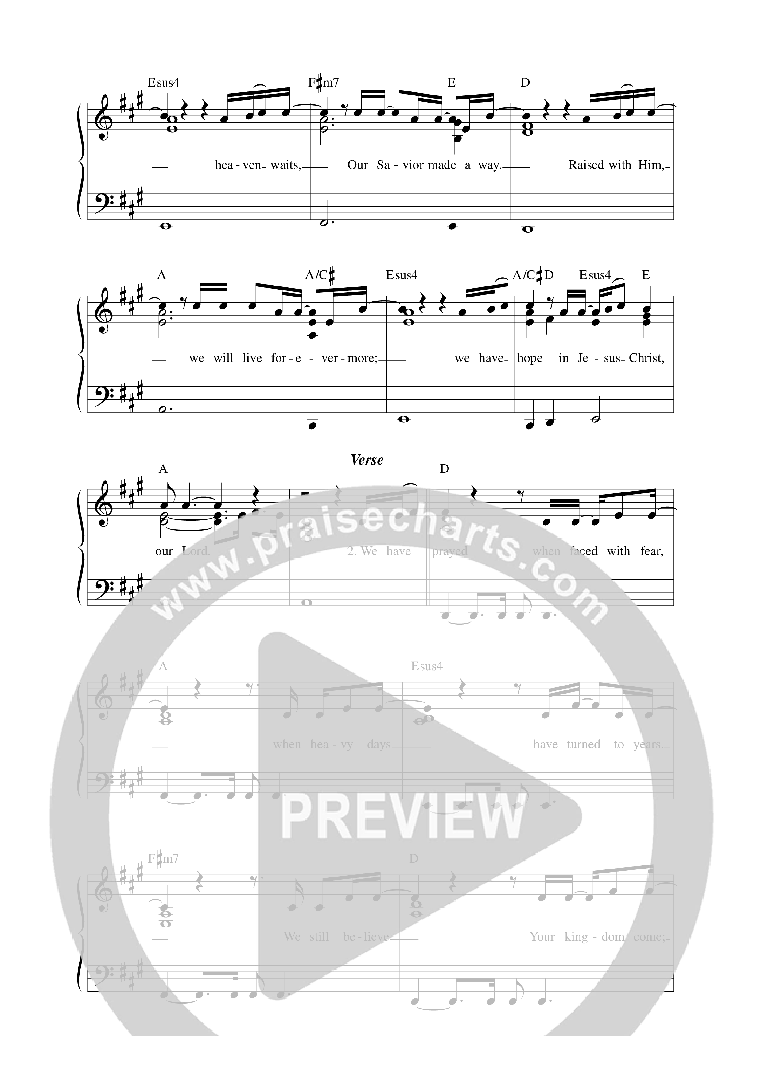 We Have Hope Lead Sheet Melody (Anchor Hymns)