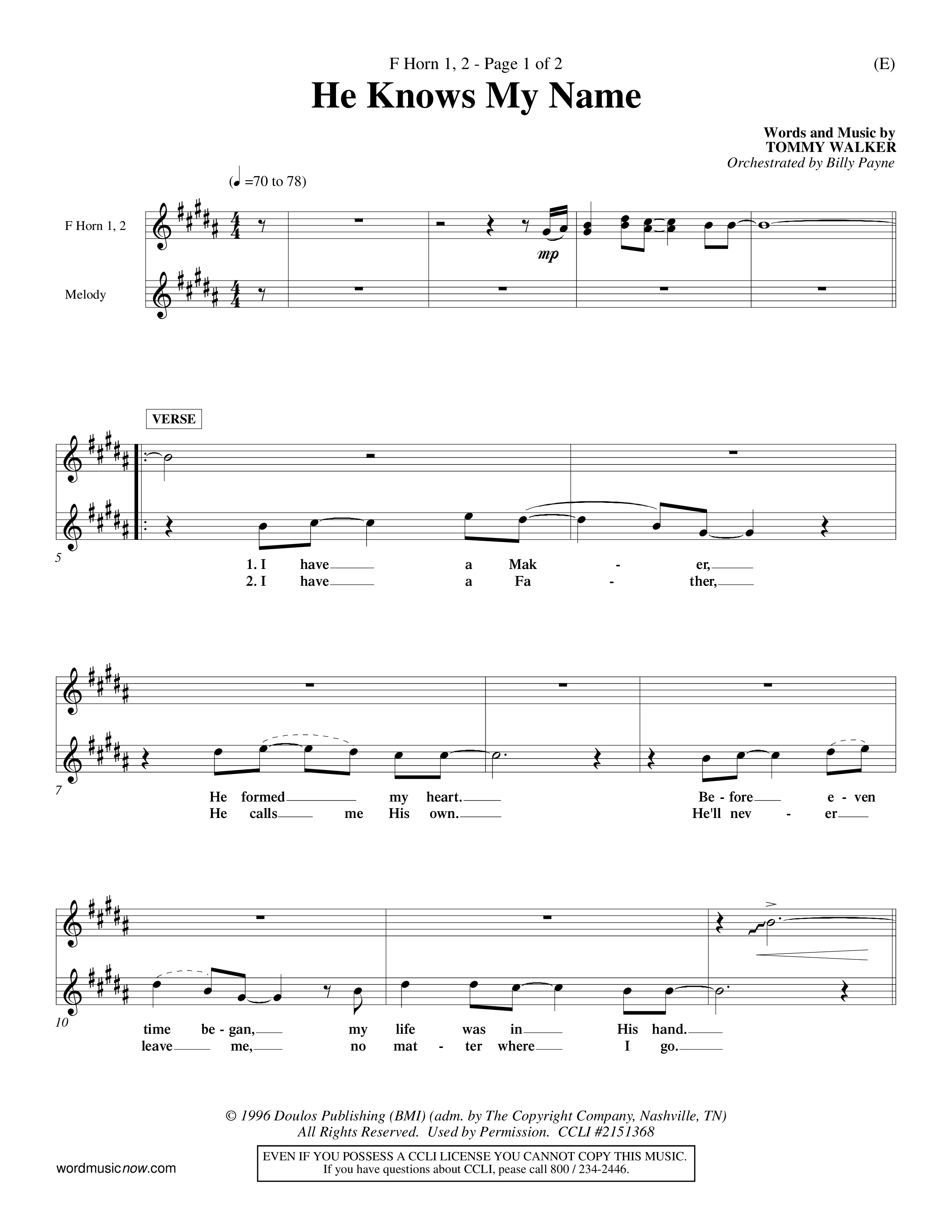 He Knows My Name (Choral Anthem SATB) French Horn (Word Music Choral / Orch. Billy Payne)