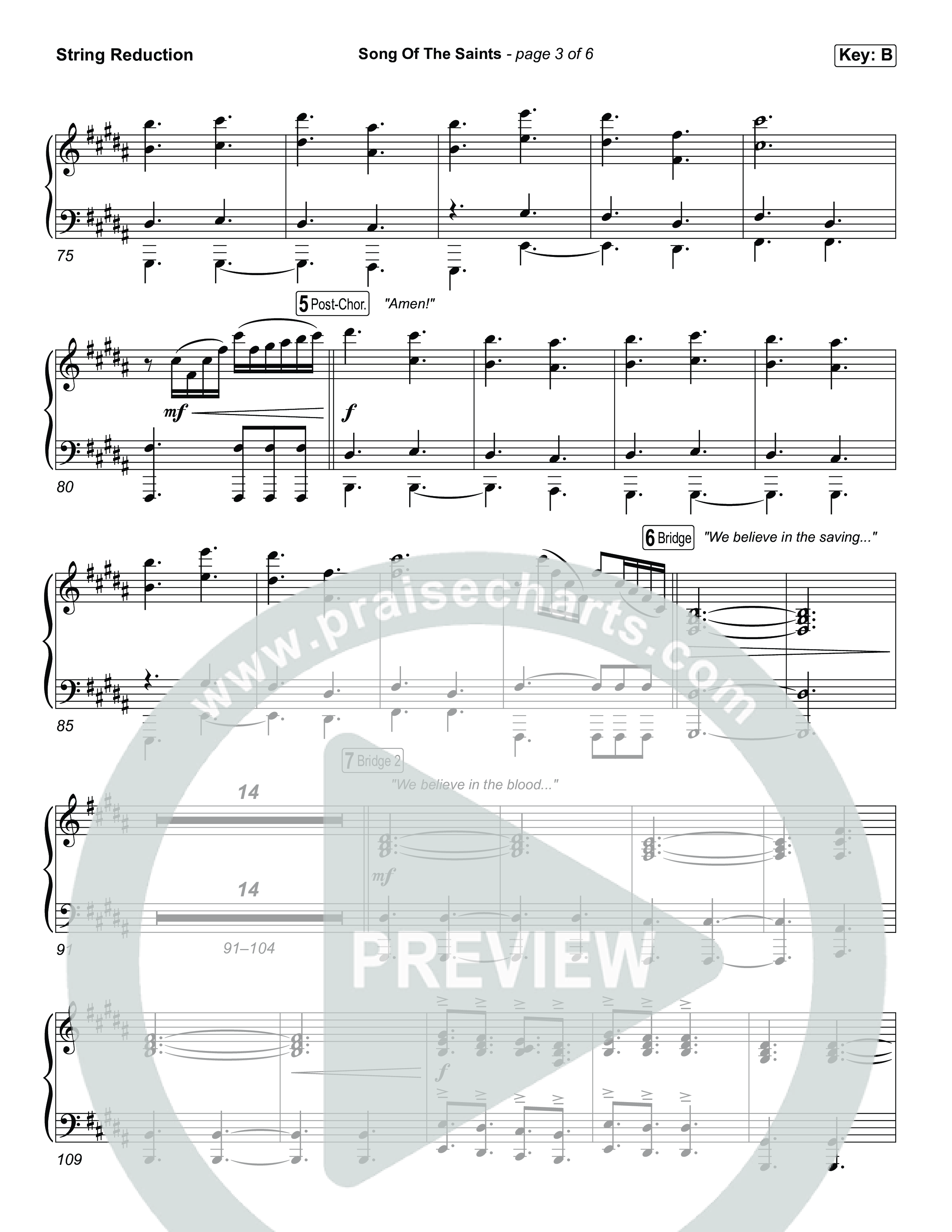 Song Of The Saints String Reduction (Phil Wickham)