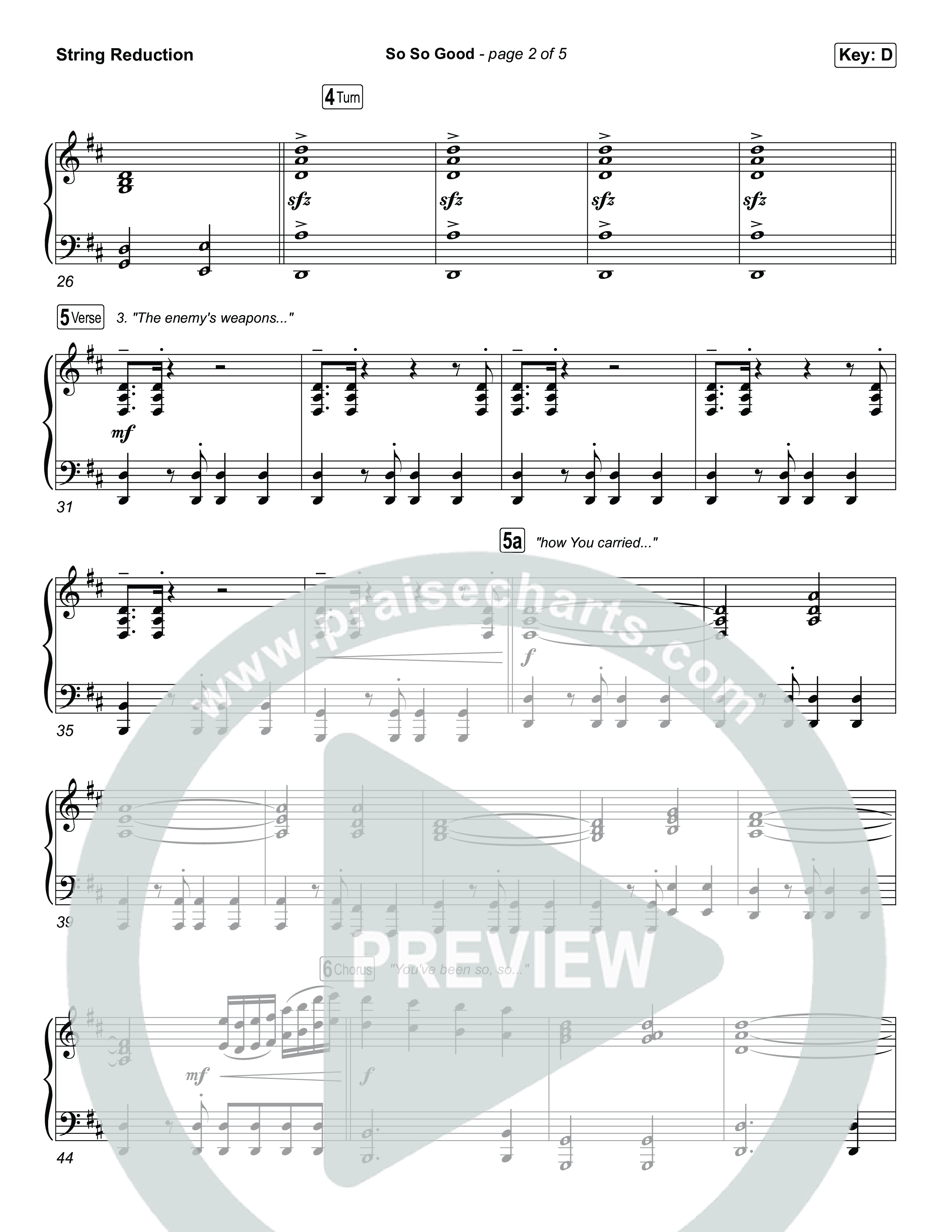 So So Good String Reduction (Phil Wickham)