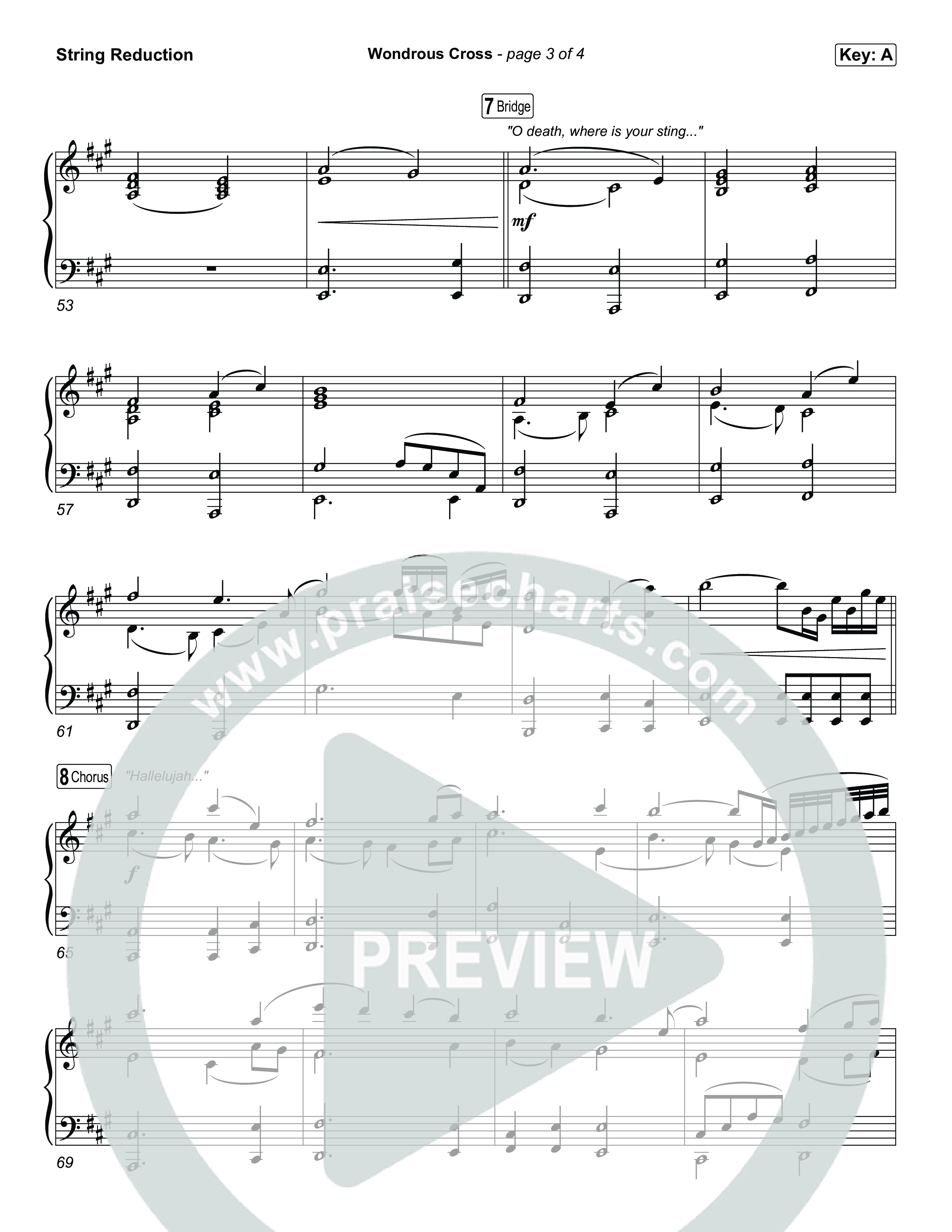 Wondrous Cross String Reduction (Phil Wickham)