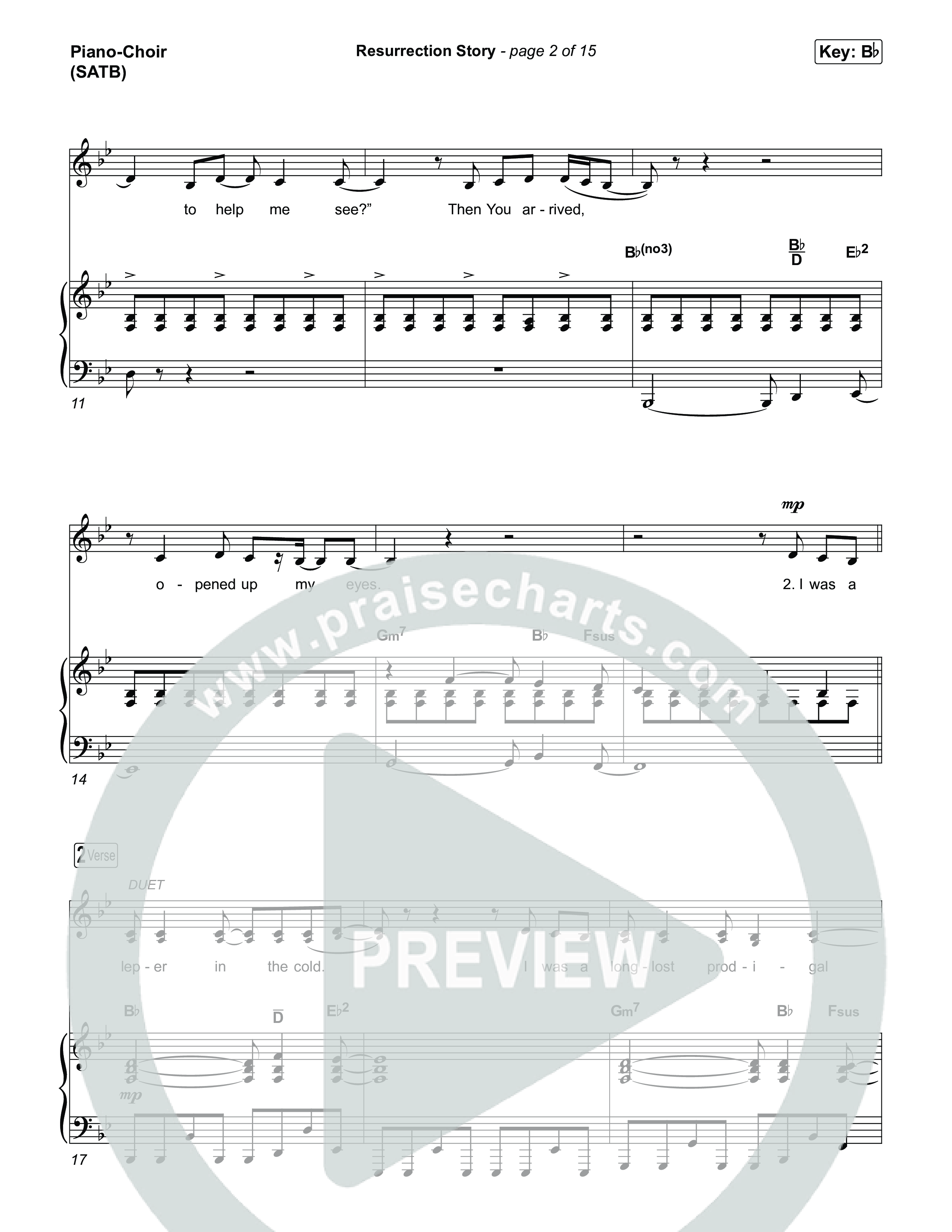 Resurrection Story Piano/Vocal Pack (Phil Wickham)