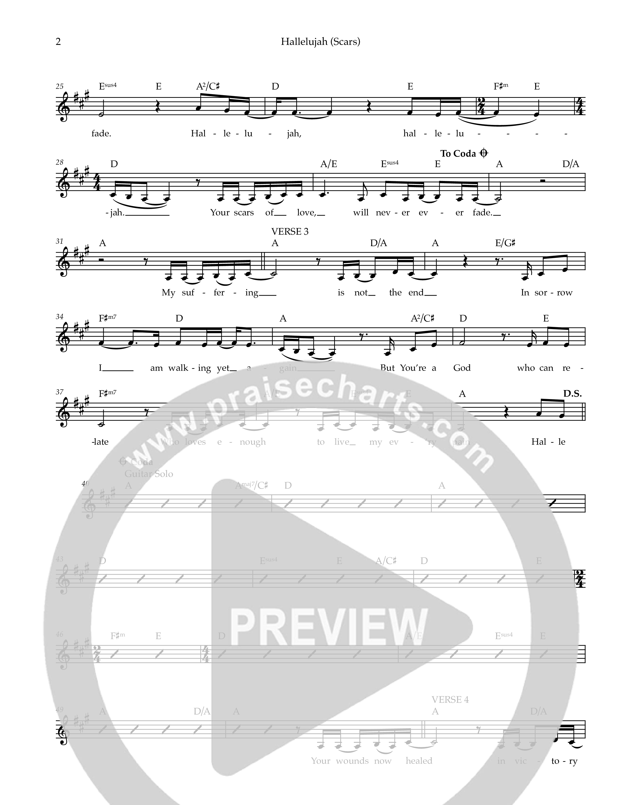 Hallelujah (Scars) Lead Sheet Melody (Ezra Worship Initiative)