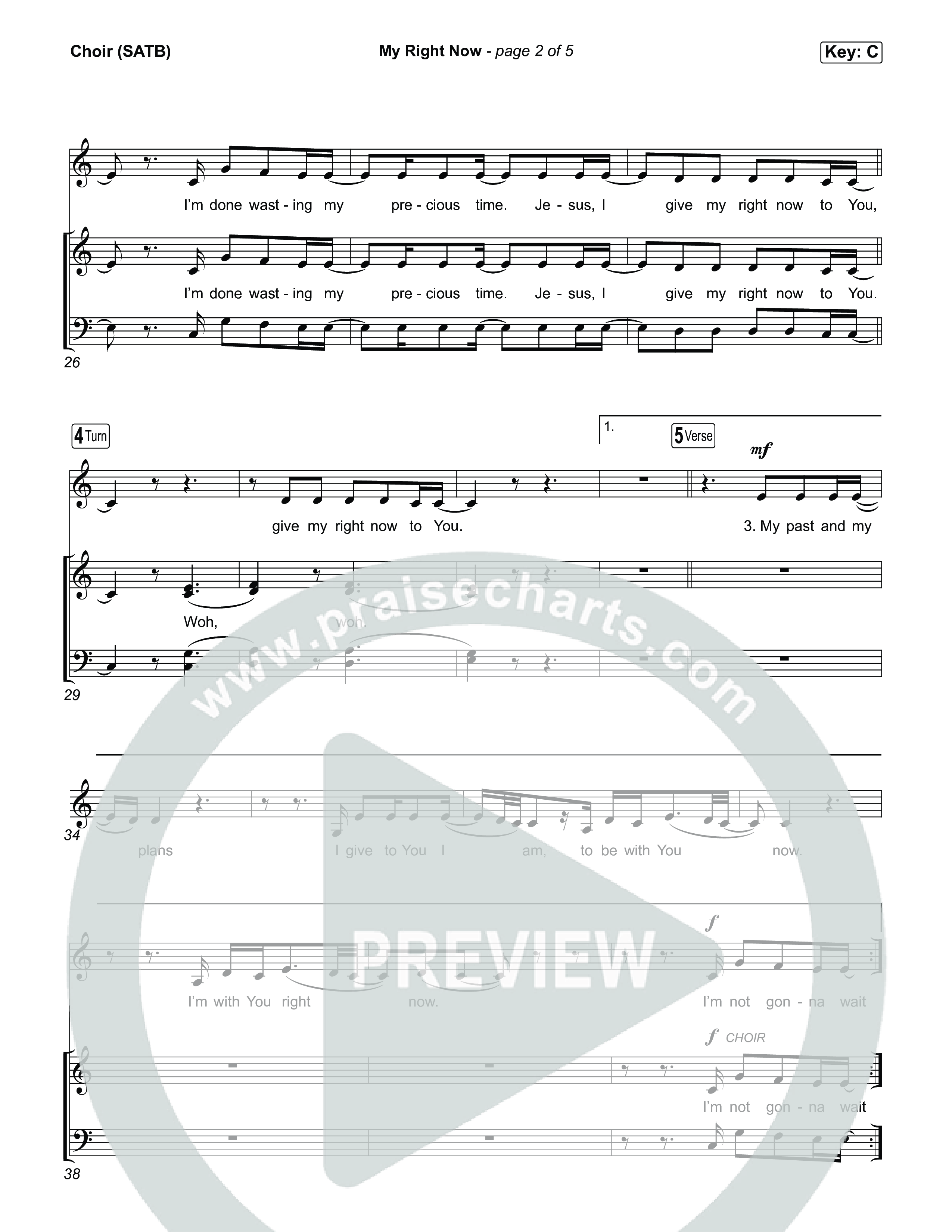 My Right Now Choir Sheet (SATB) (Stephen McWhirter)