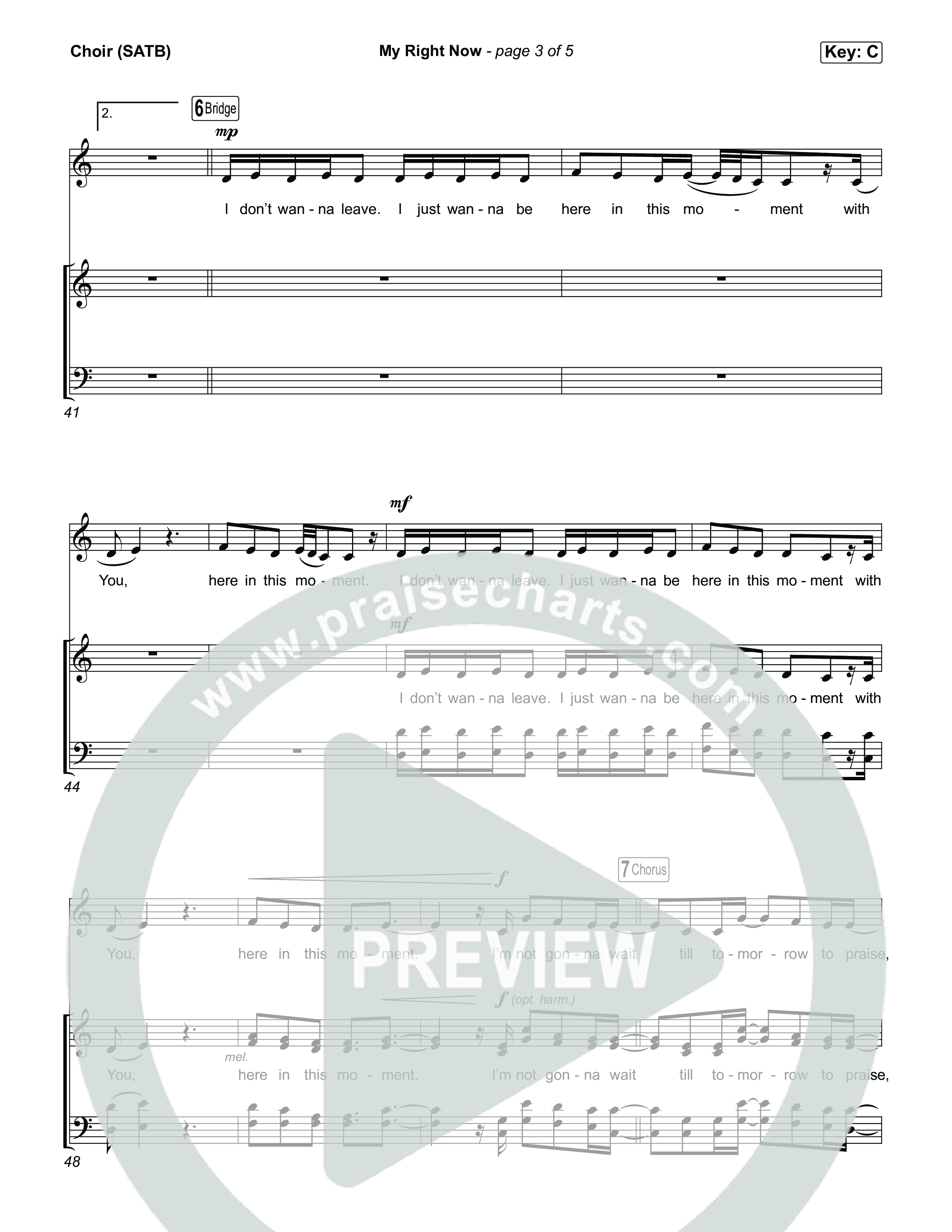 My Right Now Choir Sheet (SATB) (Stephen McWhirter)