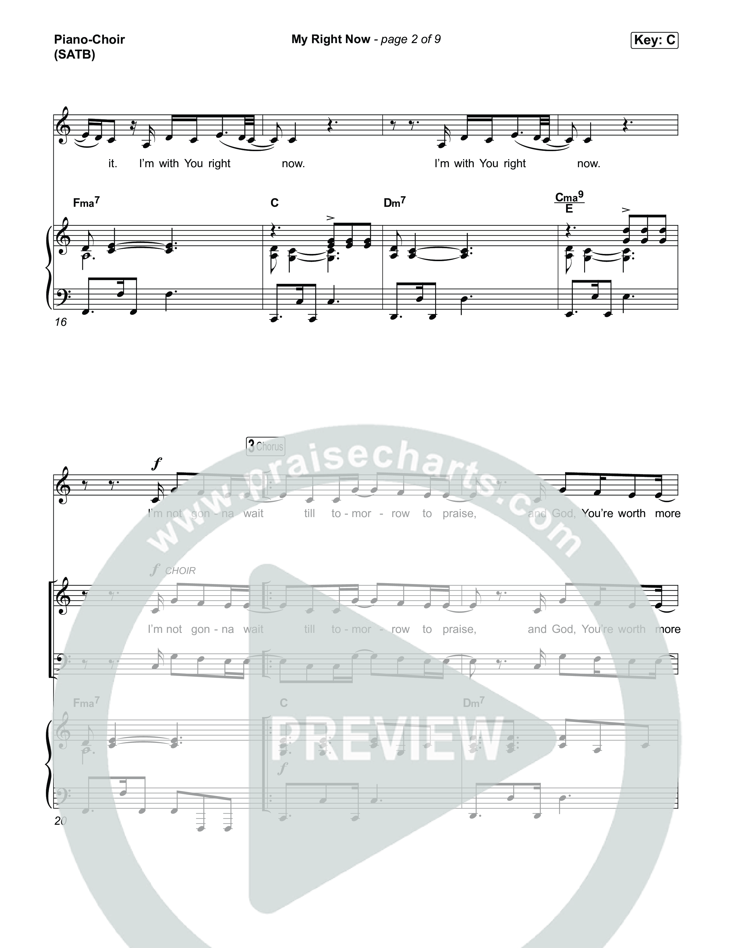 My Right Now Piano/Vocal (SATB) (Stephen McWhirter)