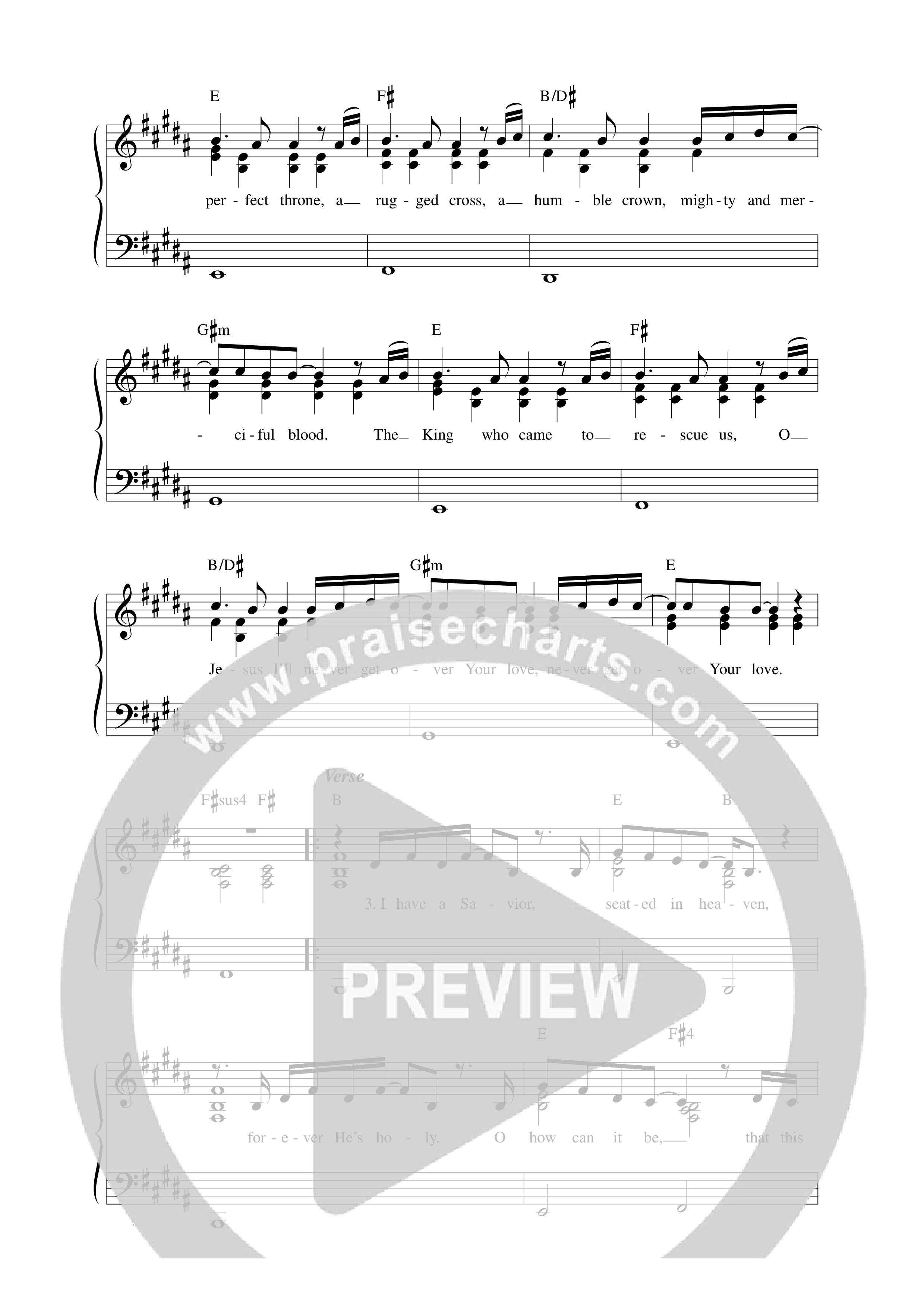 Never Get Over Lead Sheet Melody (Matt Redman)