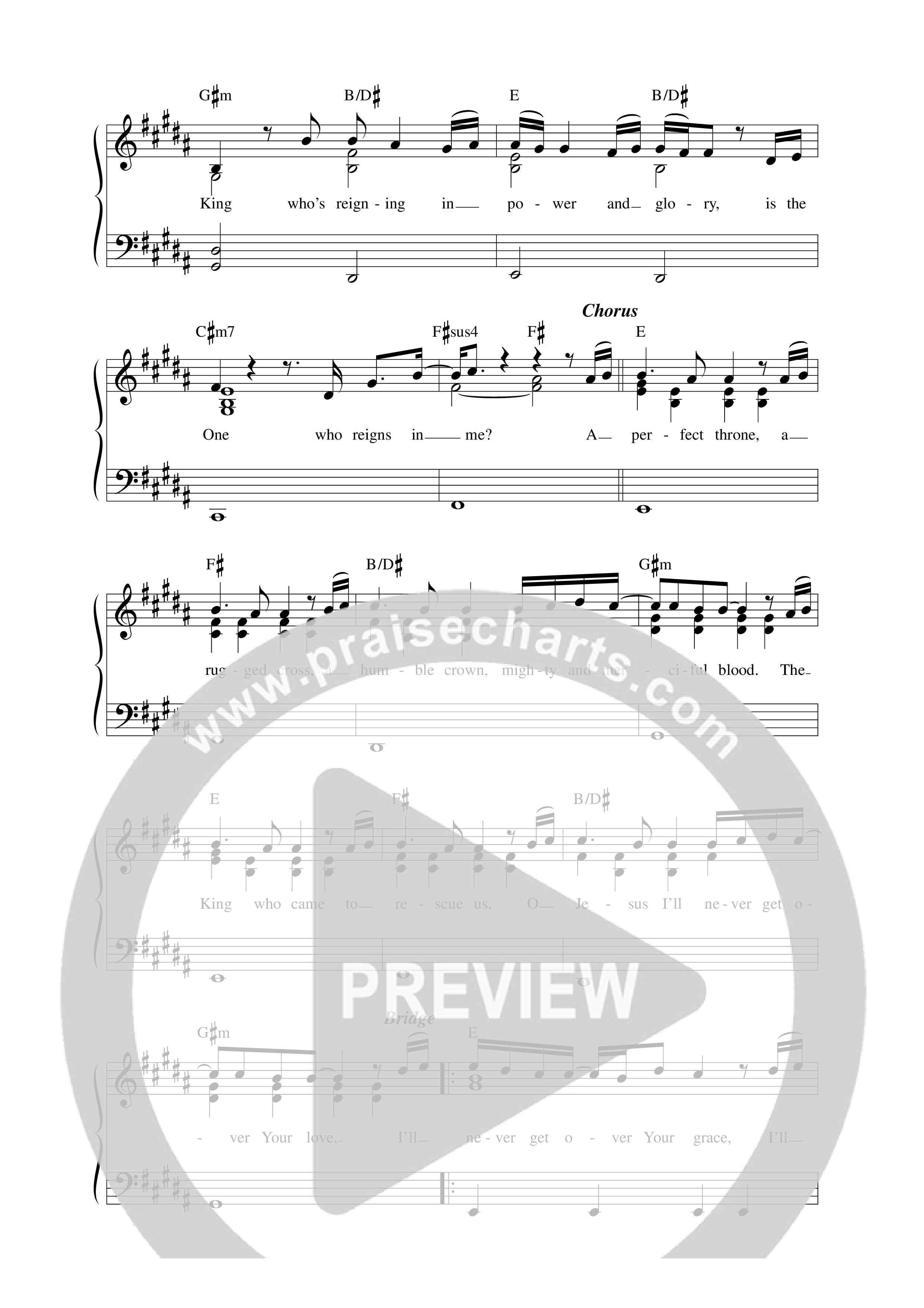Never Get Over Lead Sheet Melody (Matt Redman)