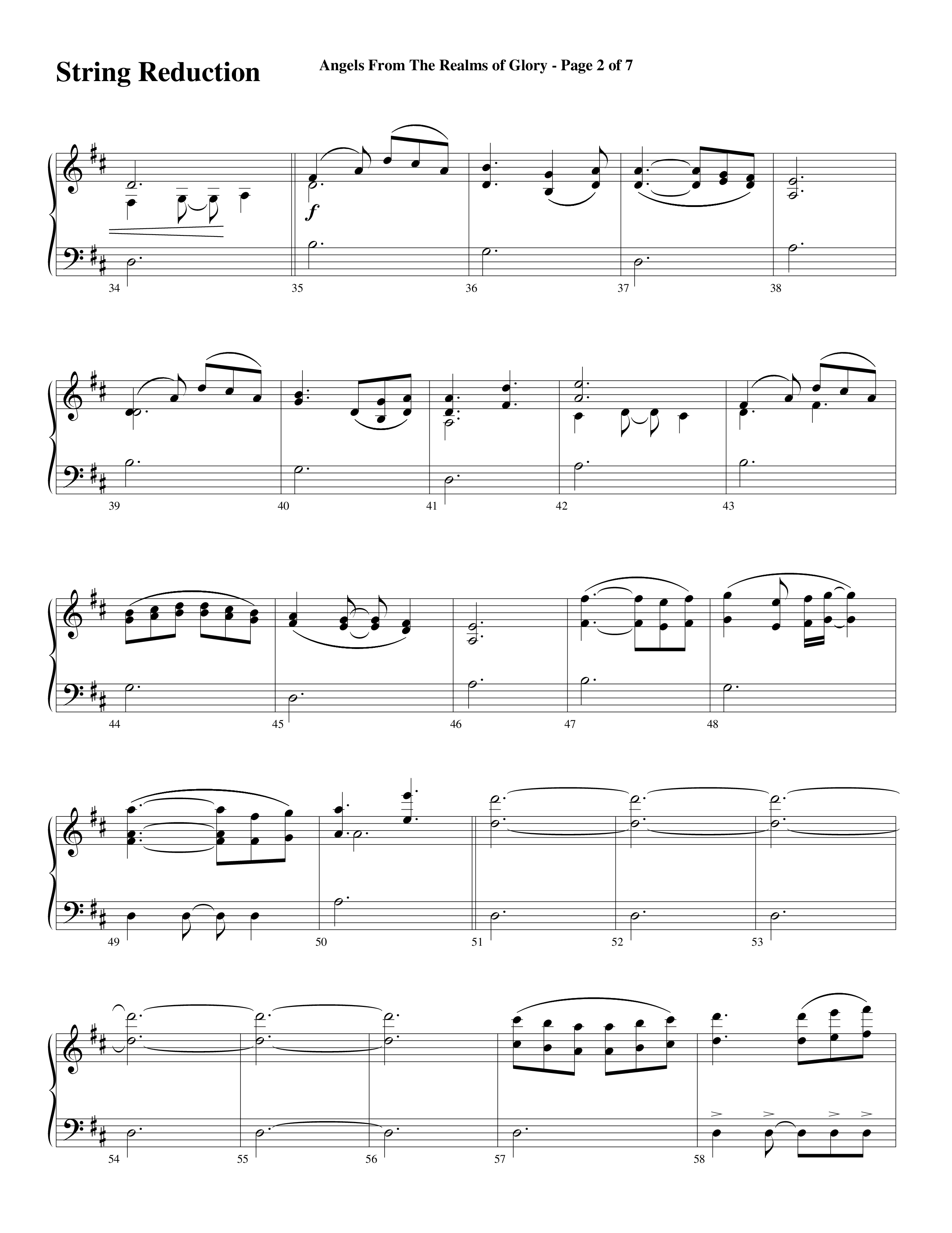 Angels From The Realms Of Glory (Come And Worship) String Reduction (Word Music Choral / Arr. Gary Rhodes / Orch. Tim Cates)