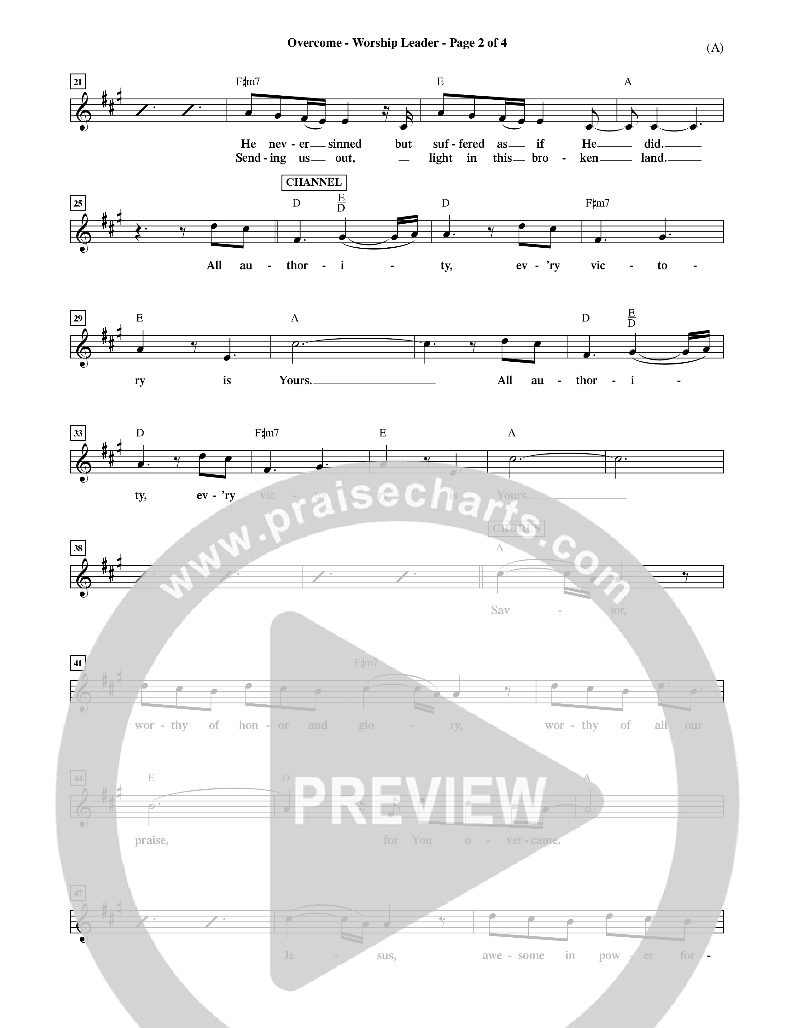Overcome (Choral Anthem SATB) Rhythm Pack (Word Music Choral / Orch. David Shipps)