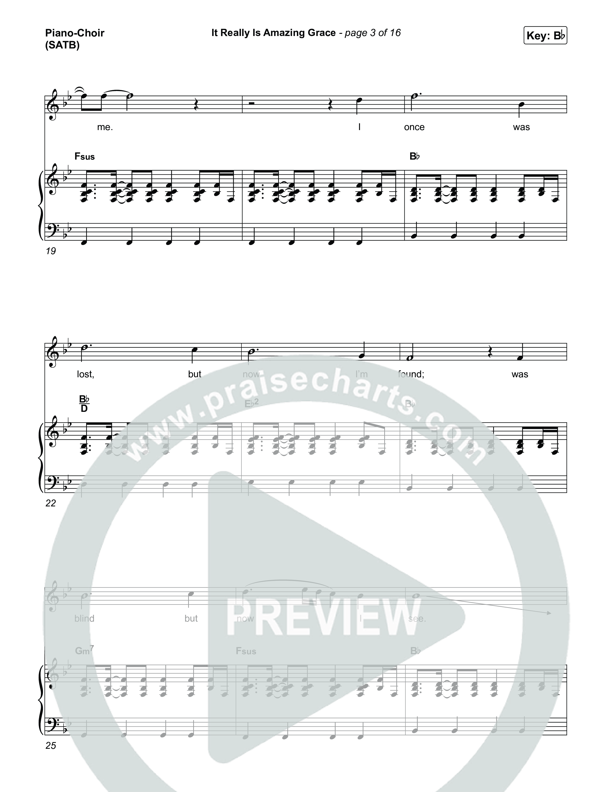 It Really Is Amazing Grace Piano/Vocal Pack (Phil Wickham / Crowder)