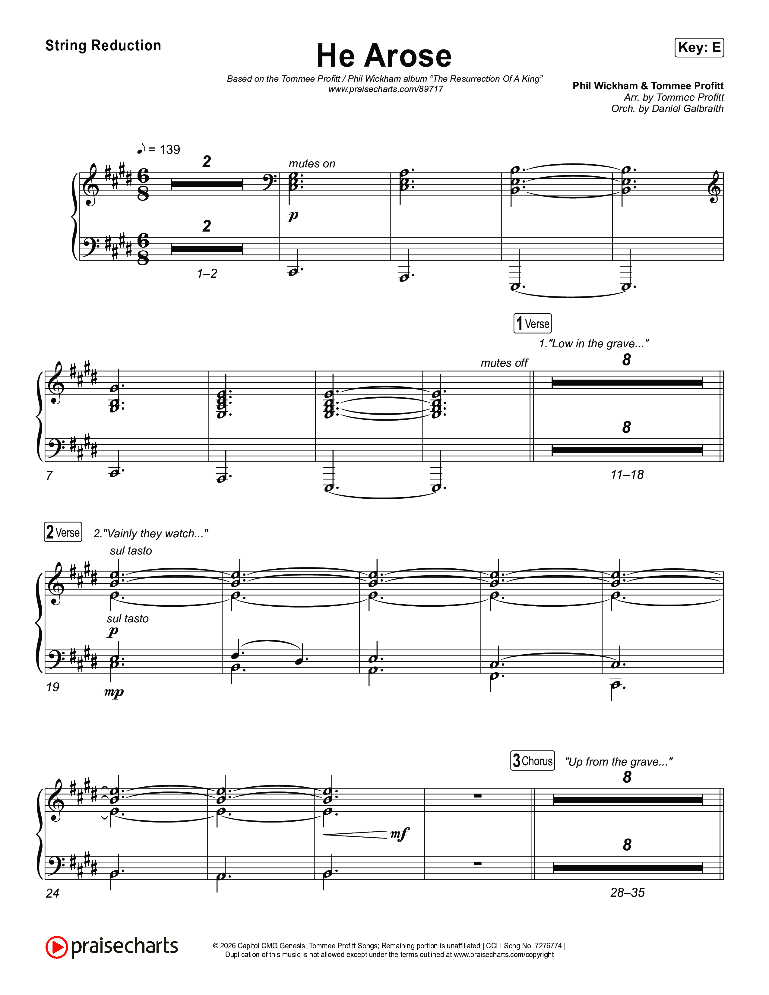 He Arose String Reduction (Tommee Profitt / Phil Wickham)
