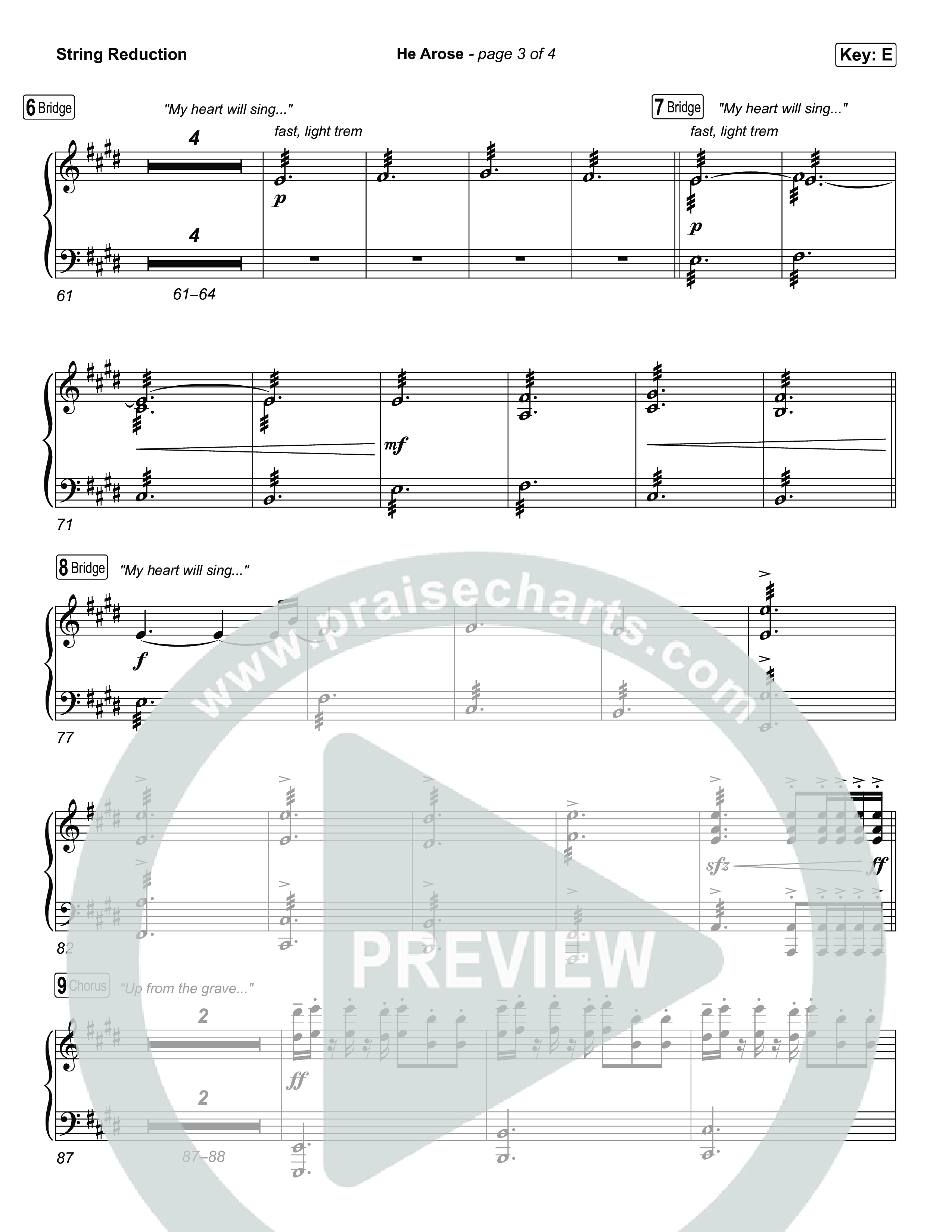 He Arose String Reduction (Tommee Profitt / Phil Wickham)