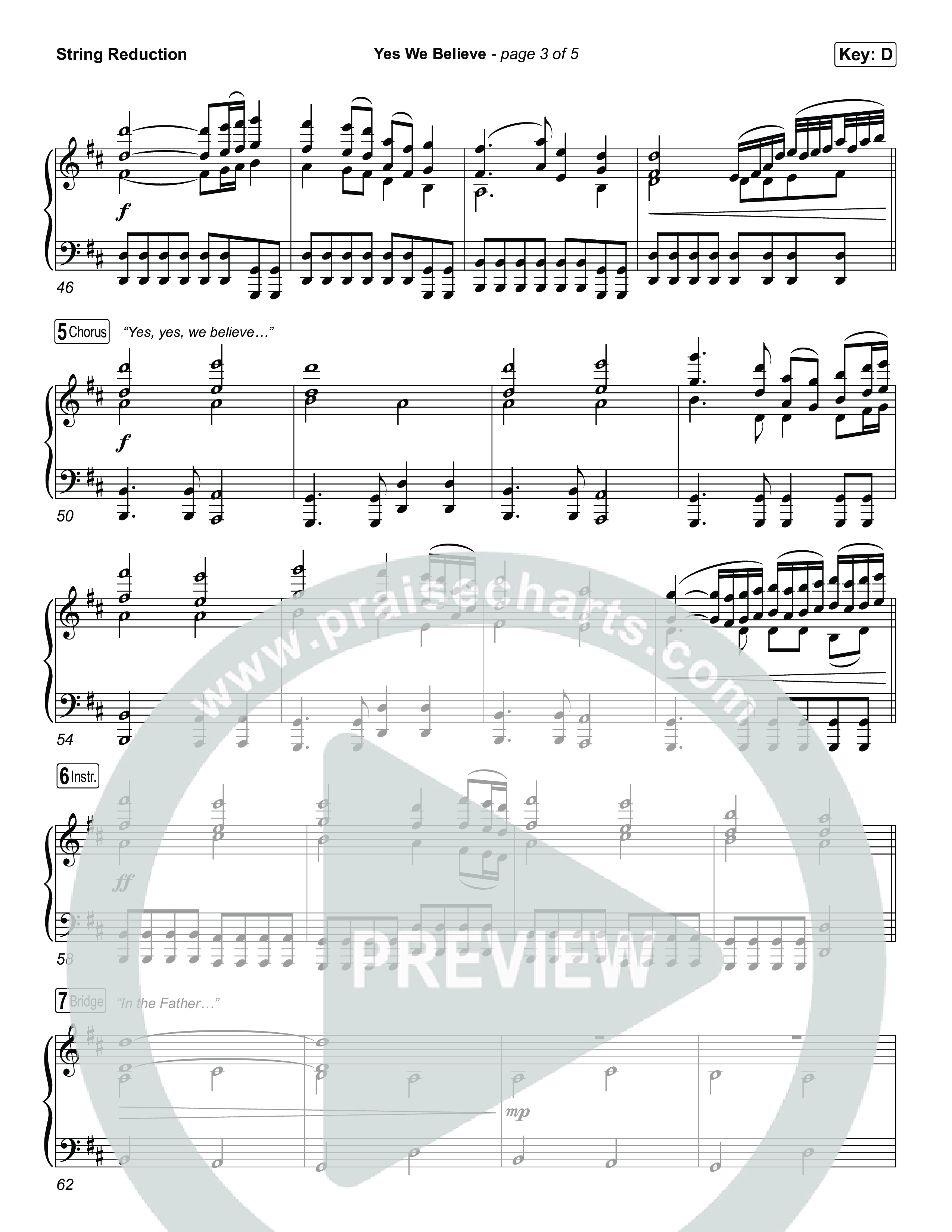 Yes We Believe String Reduction (Paul Baloche)