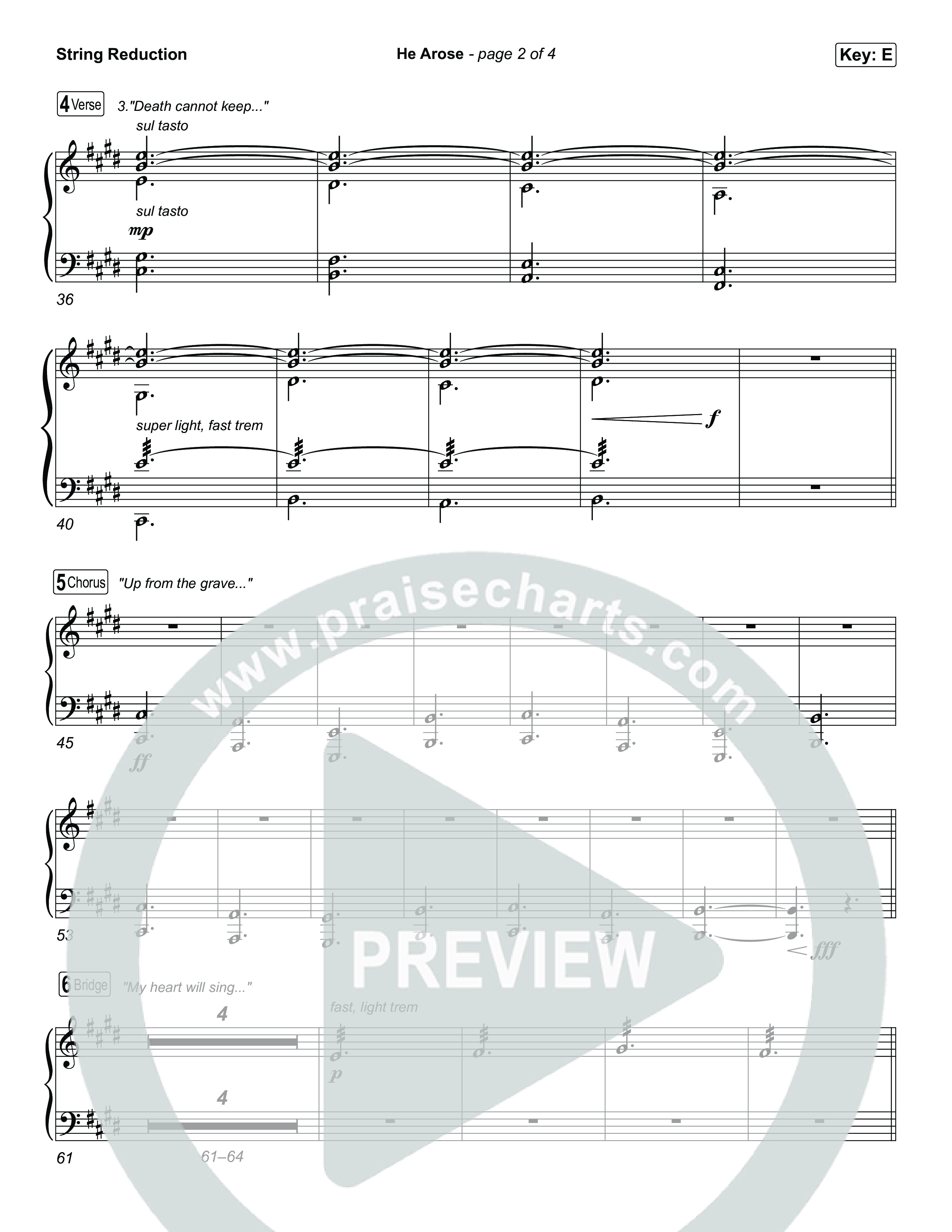 He Arose (Choral Anthem SATB) String Reduction (Tommee Profitt / Phil Wickham / Arr. Luke Gambill)