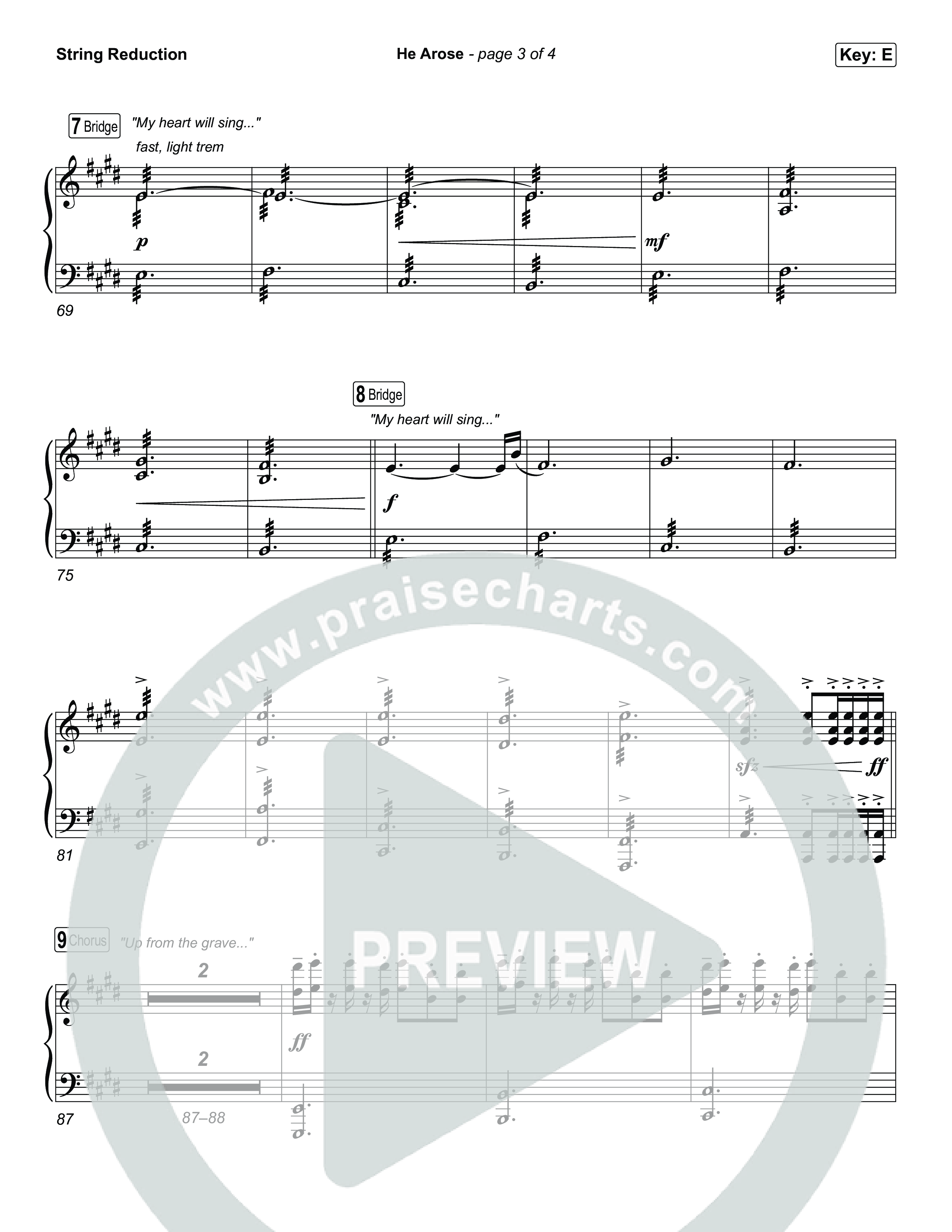 He Arose (Choral Anthem SATB) String Reduction (Tommee Profitt / Phil Wickham / Arr. Luke Gambill)