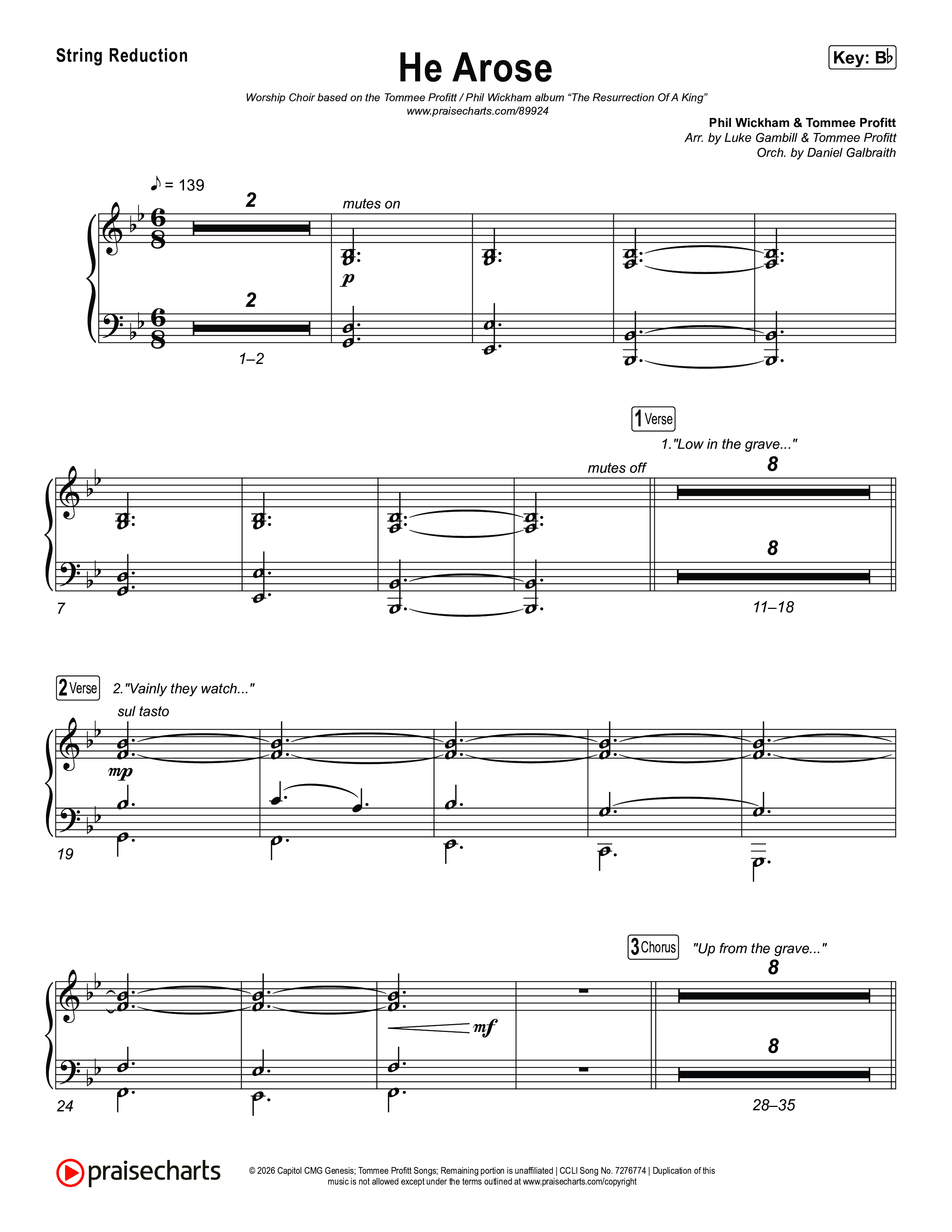 He Arose (Worship Choir/SAB) String Reduction (Tommee Profitt / Phil Wickham / Arr. Luke Gambill)