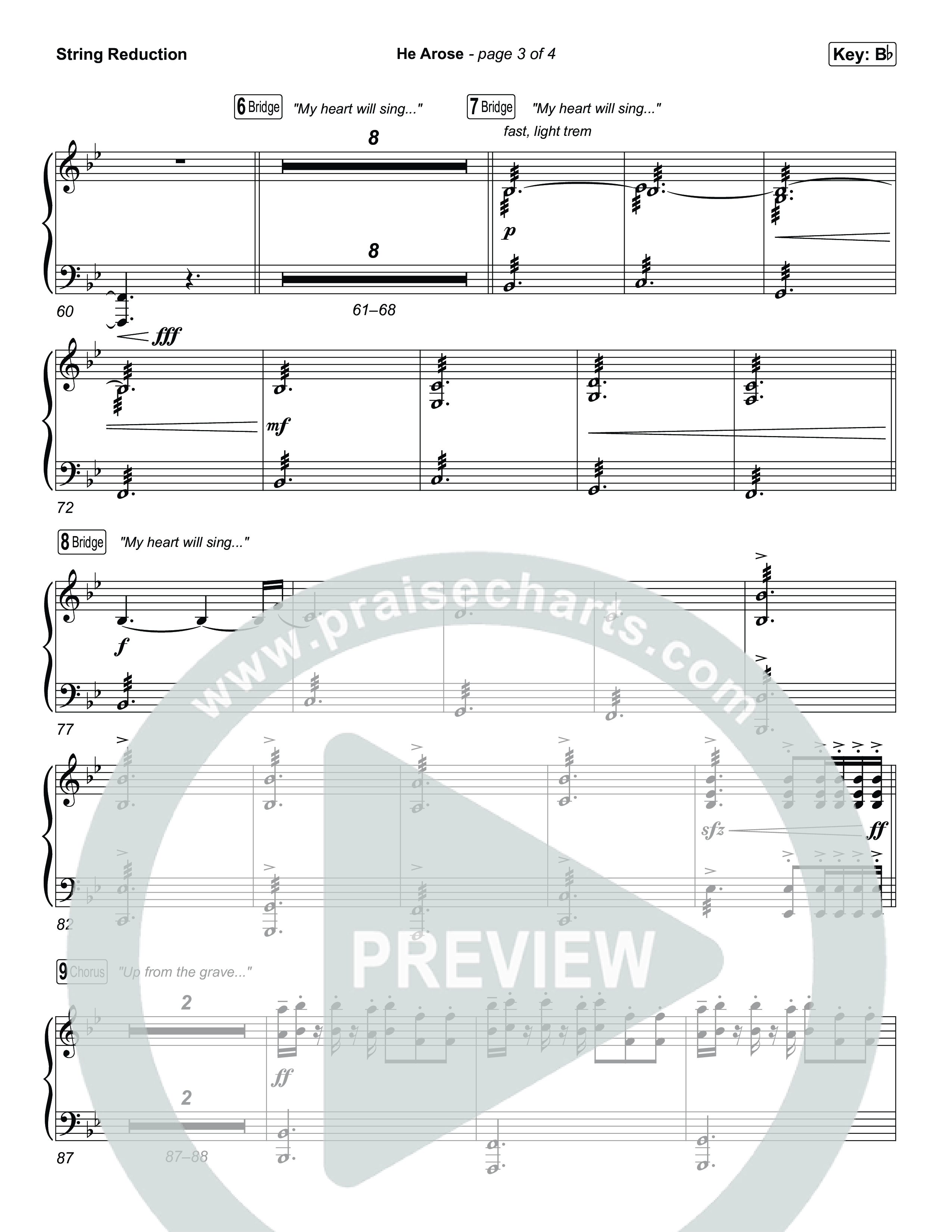 He Arose (Unison/2-Part) String Reduction (Tommee Profitt / Phil Wickham / Arr. Luke Gambill)