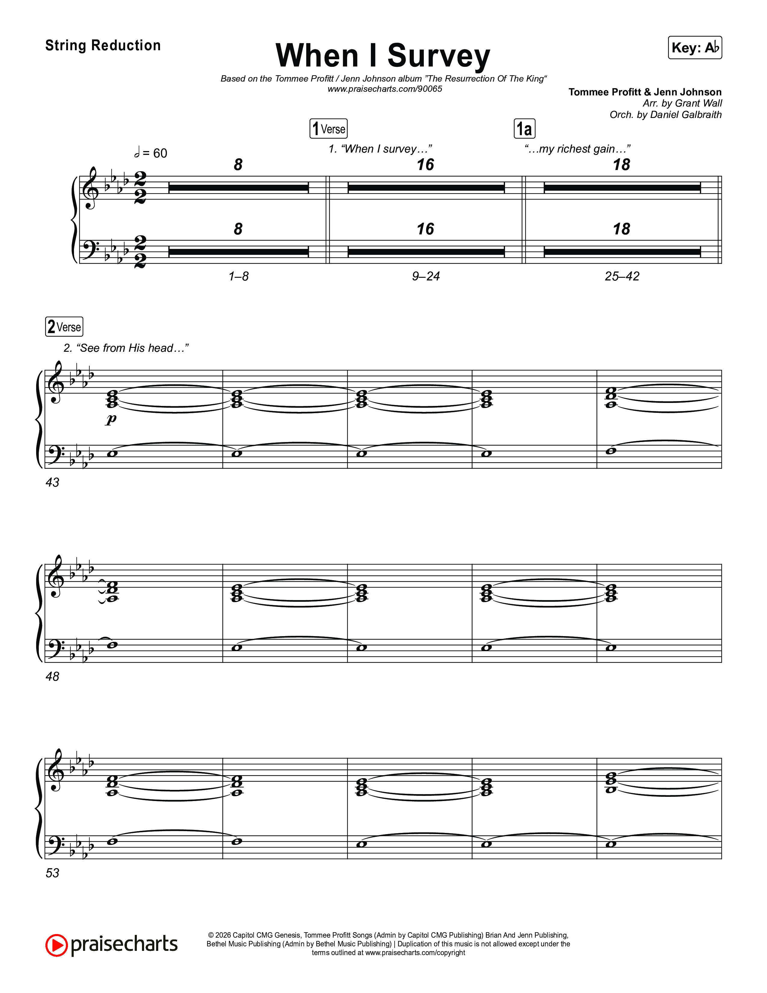 When I Survey String Reduction (Tommee Profitt / Jenn Johnson)
