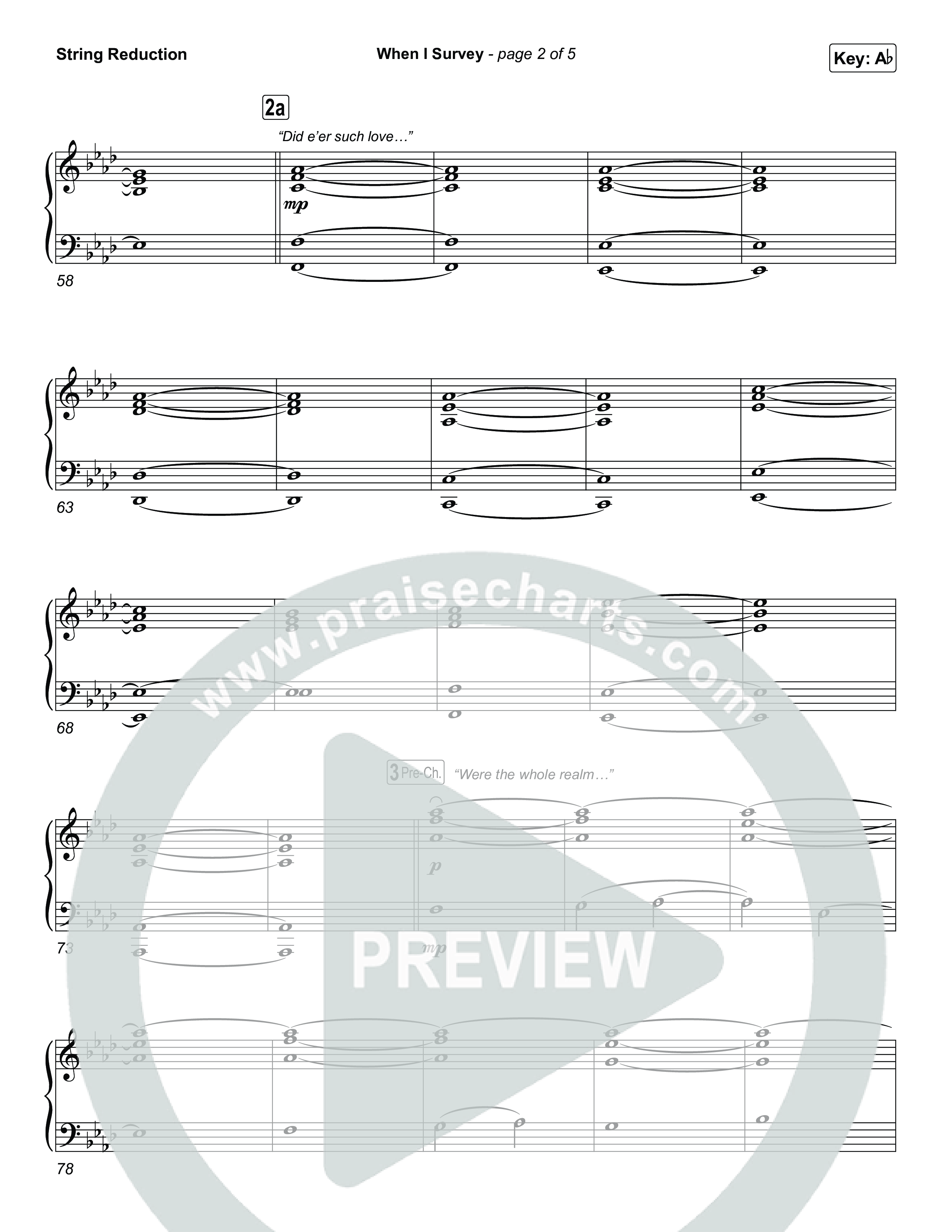 When I Survey String Reduction (Tommee Profitt / Jenn Johnson)