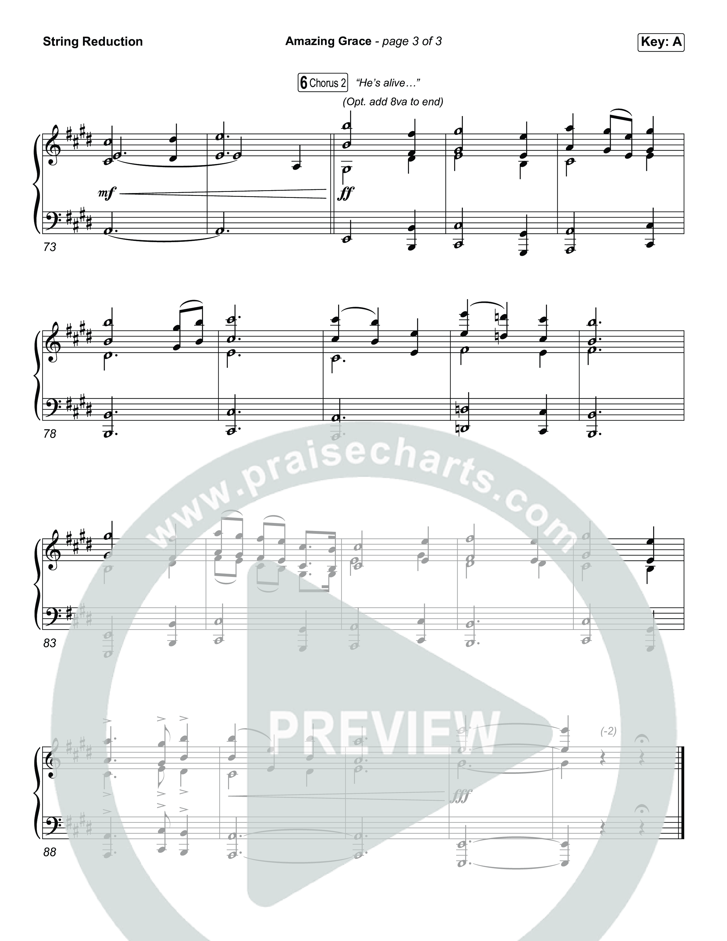 Amazing Grace (He's Alive) String Reduction (Tommee Profitt / Stanaj)