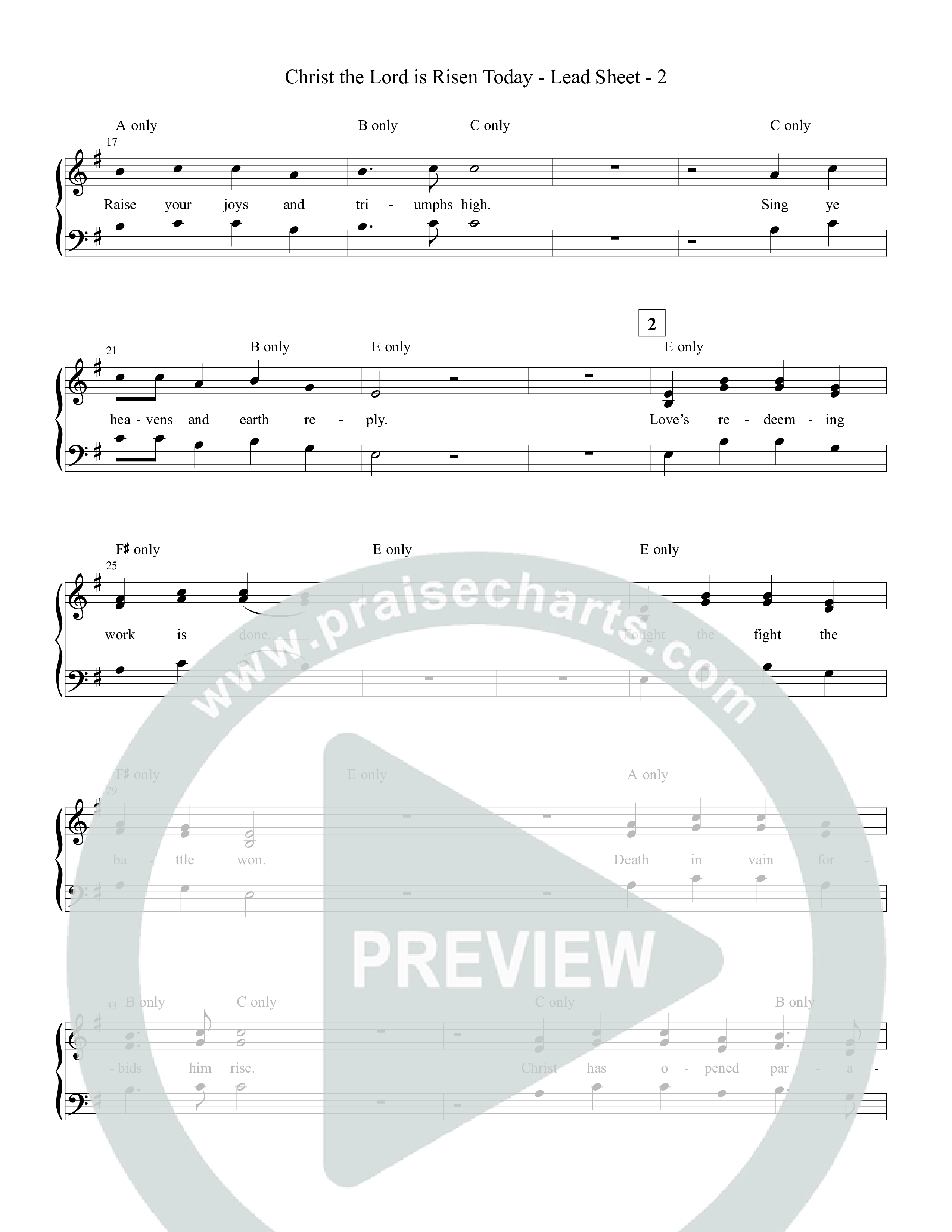 Christ The Lord Is Risen Today Piano/Vocal Pack (Tommee Profitt)