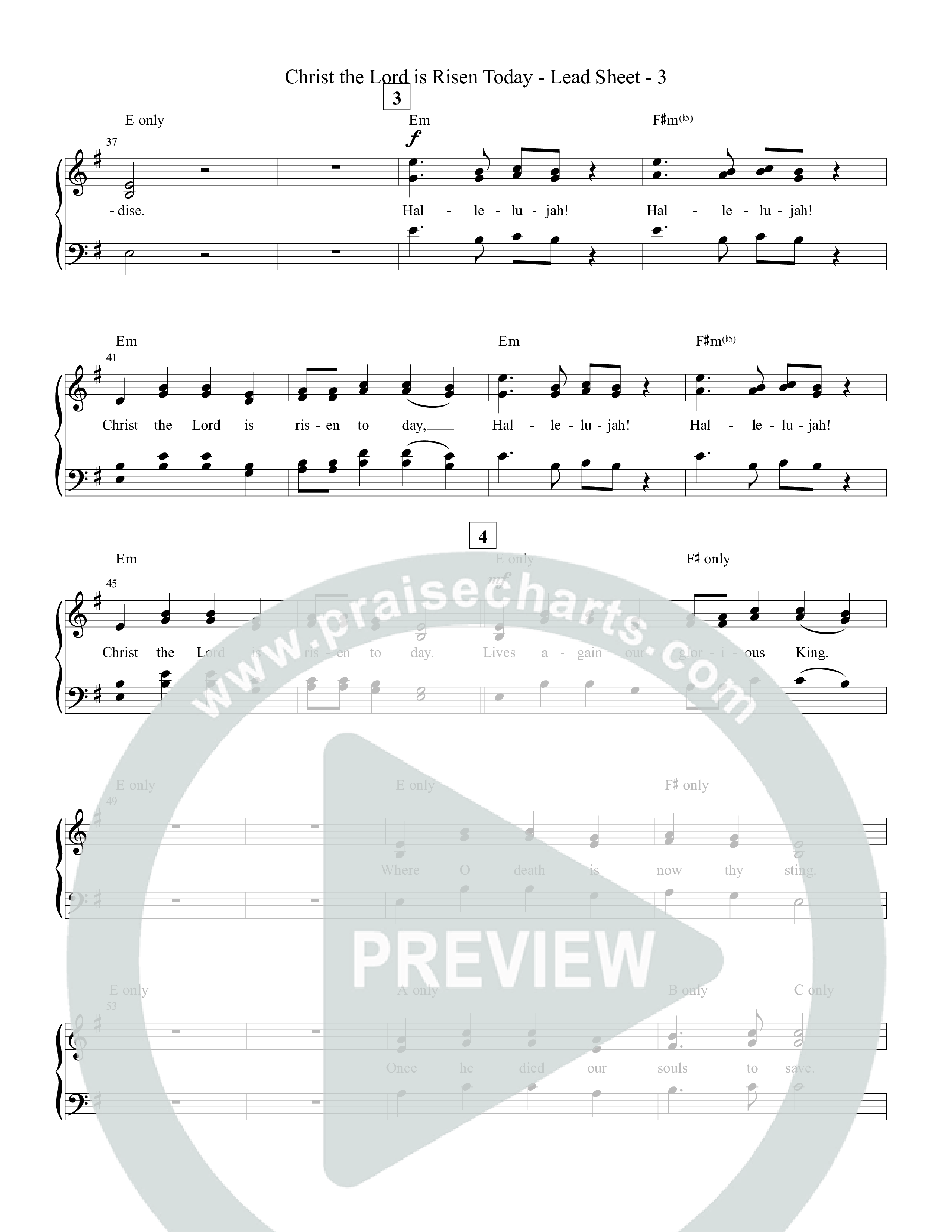 Christ The Lord Is Risen Today Piano/Vocal Pack (Tommee Profitt)