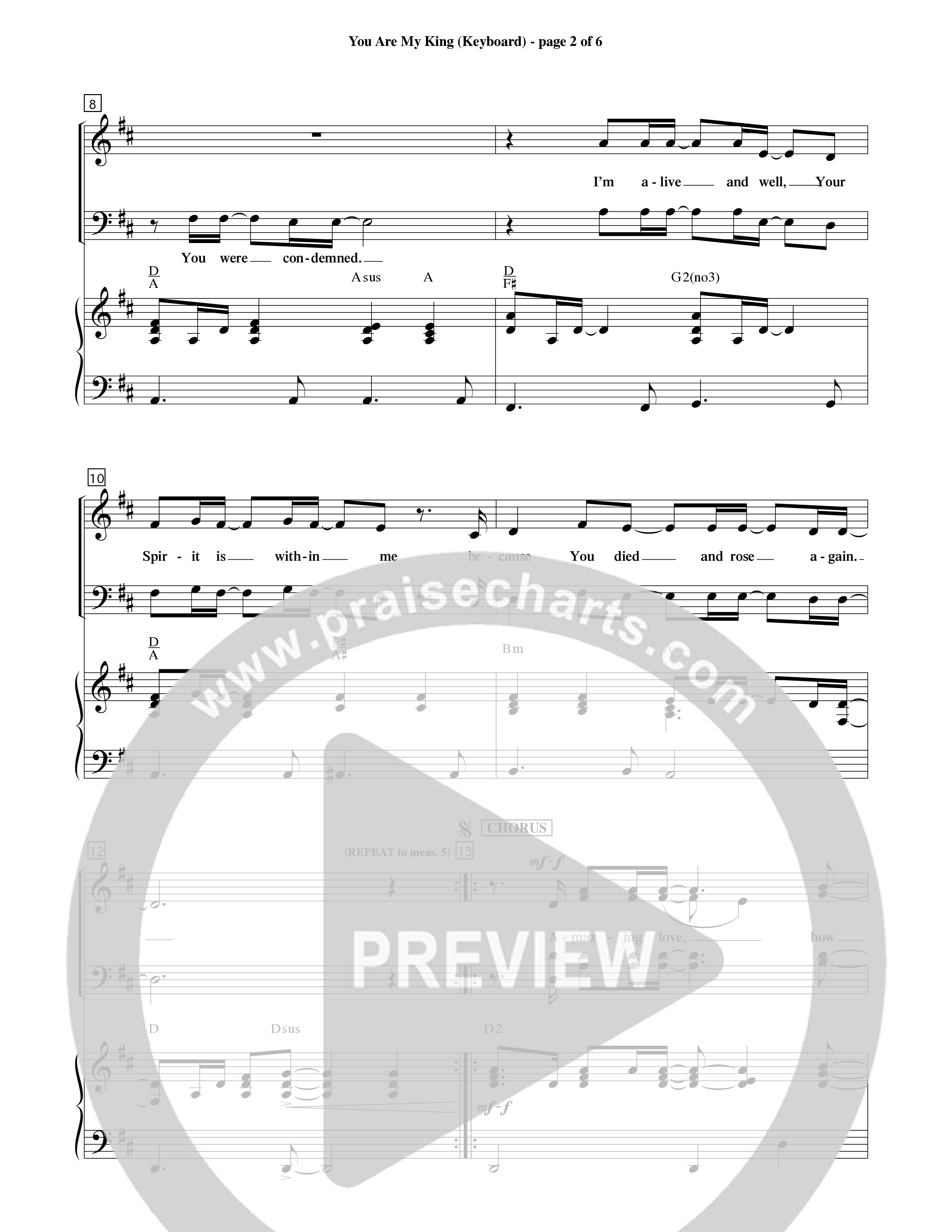 You Are My King (Amazing Love) (Choral Anthem SATB) Keyboard/Vocal (SATB) (Word Music Choral / Orch. Billy Payne)