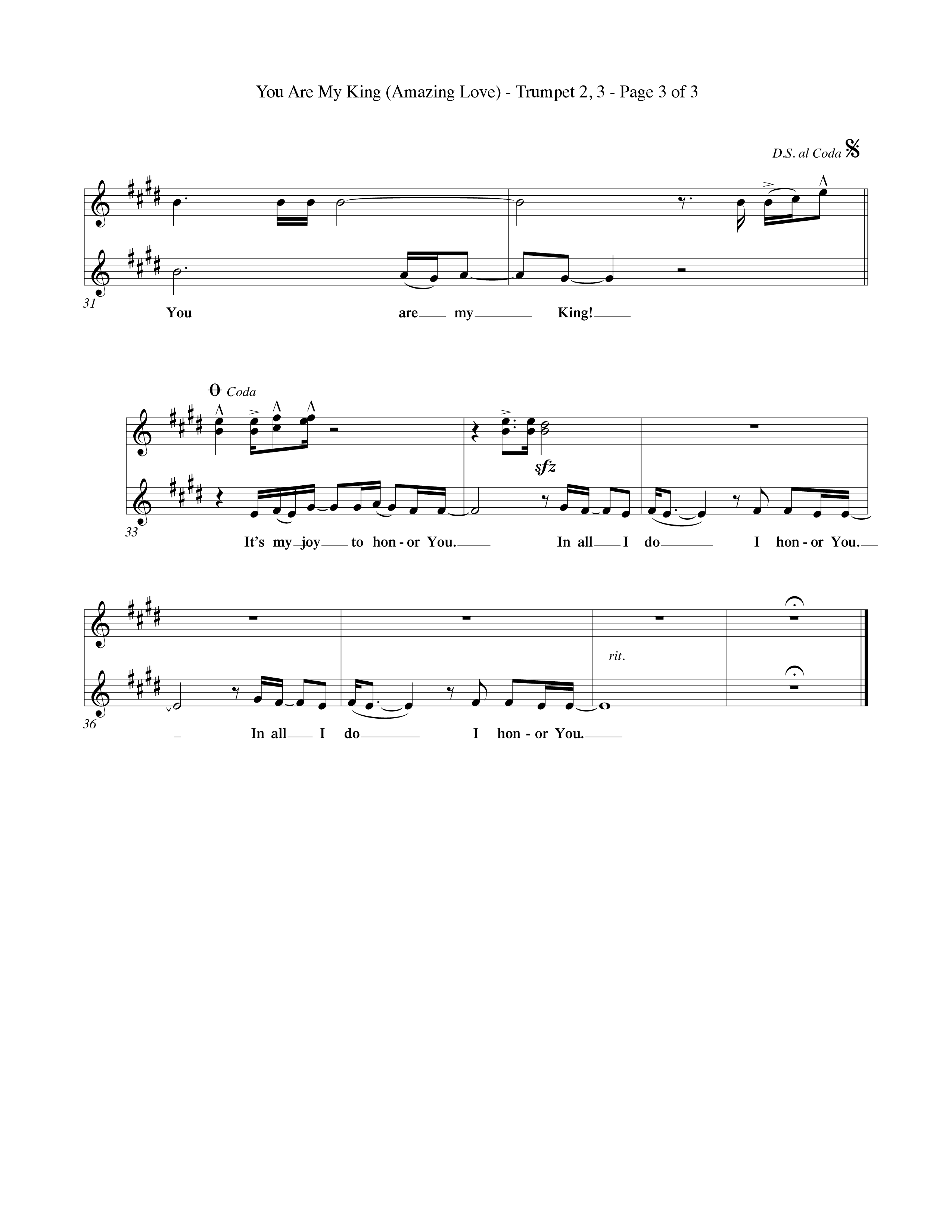 You Are My King (Amazing Love) (Choral Anthem SATB) Trumpet 2/3 (Word Music Choral / Orch. Billy Payne)