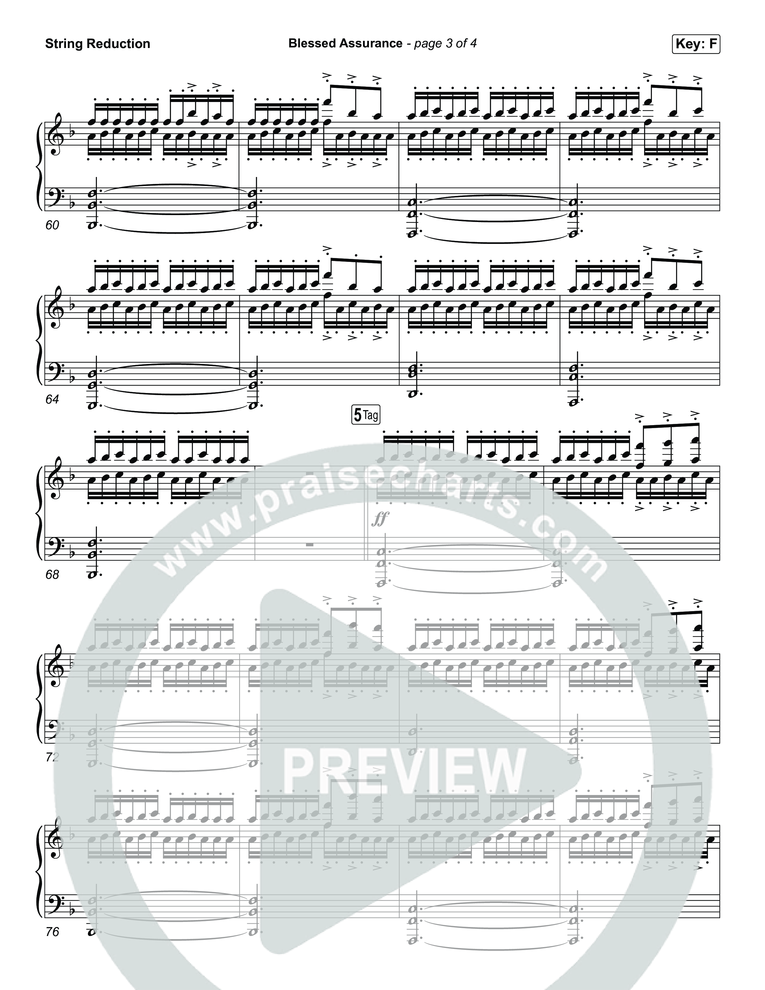 Blessed Assurance (I Will Praise You) String Reduction (Tommee Profitt)