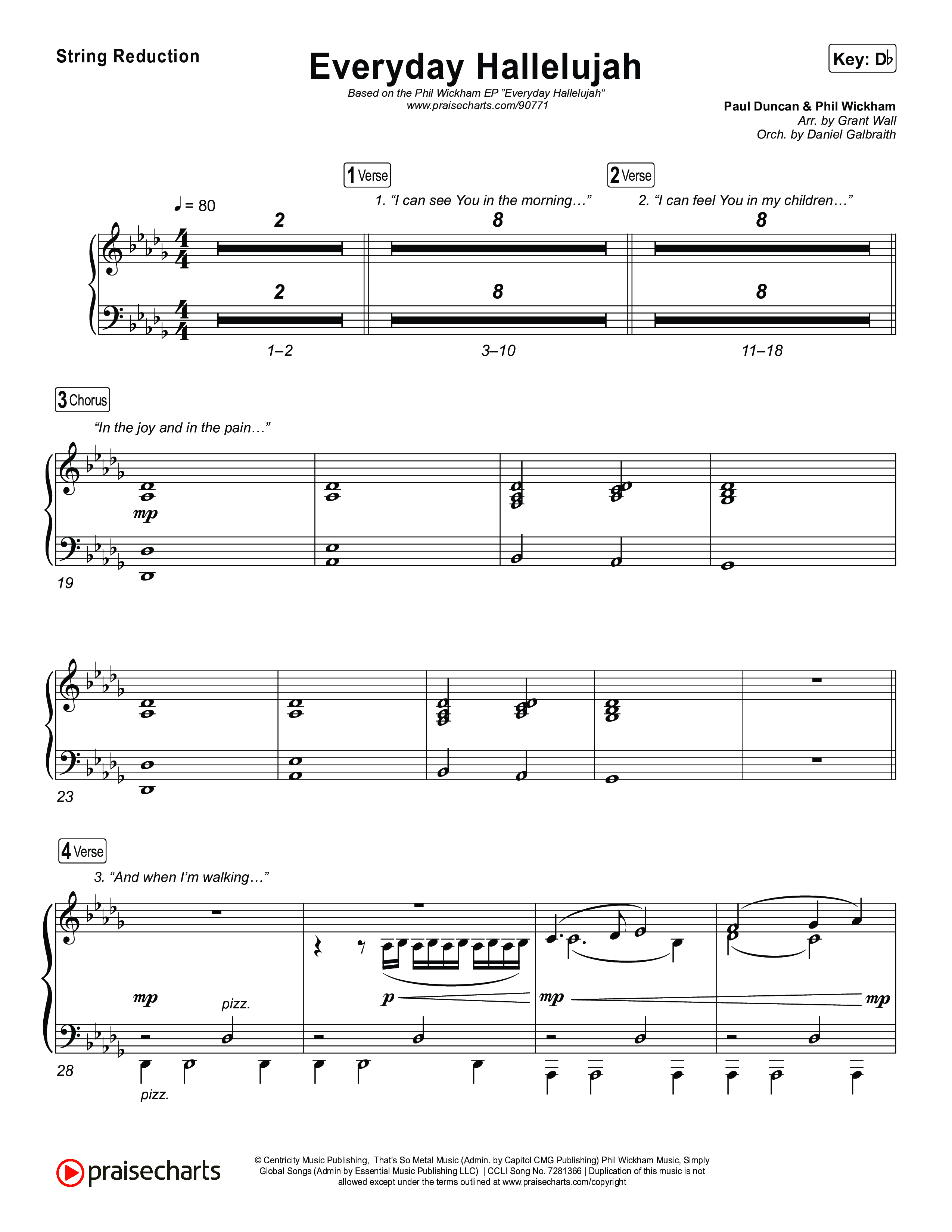Everyday Hallelujah String Reduction (Phil Wickham)