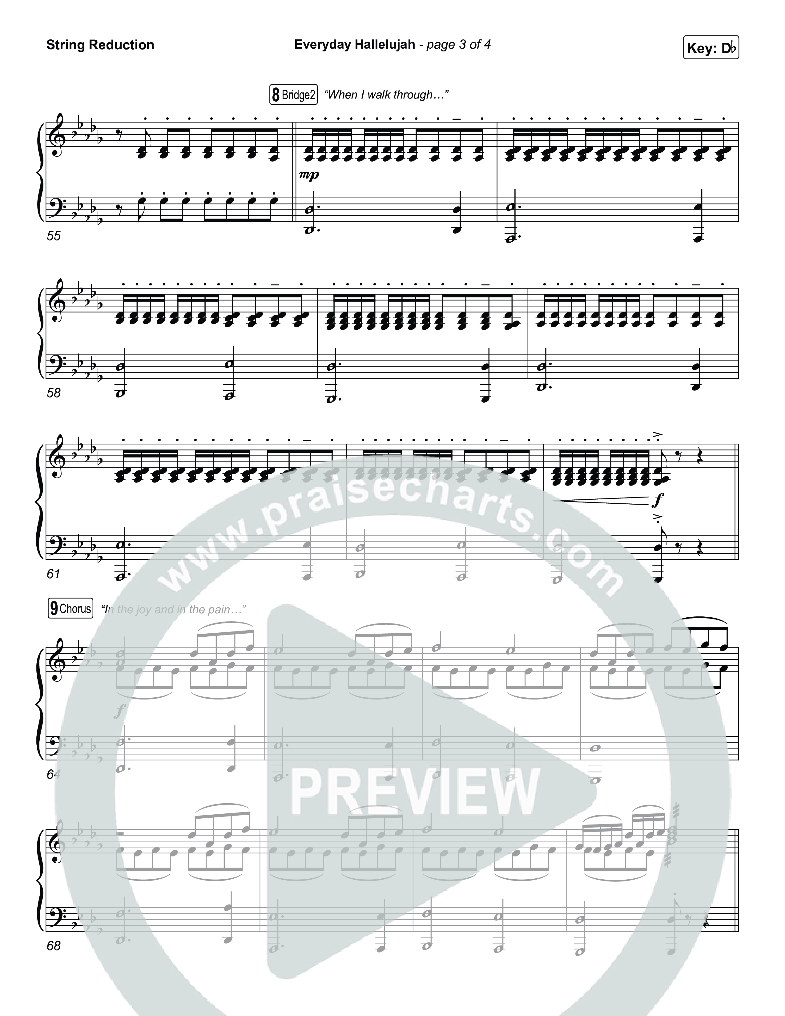 Everyday Hallelujah String Reduction (Phil Wickham)