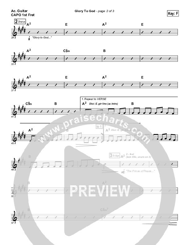 Glory To God Acoustic Guitar (Lincoln Brewster)