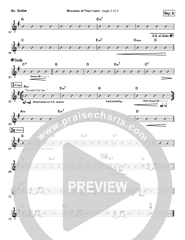 Because Of Your Love Acoustic Guitar (Phil Wickham)