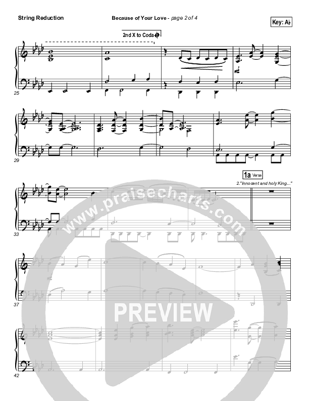 Because Of Your Love String Reduction (Phil Wickham)