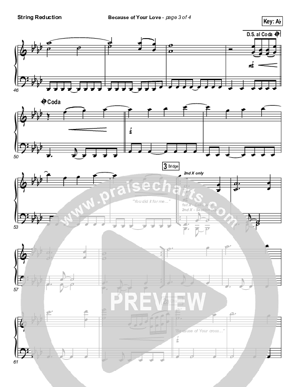 Because Of Your Love String Reduction (Phil Wickham)